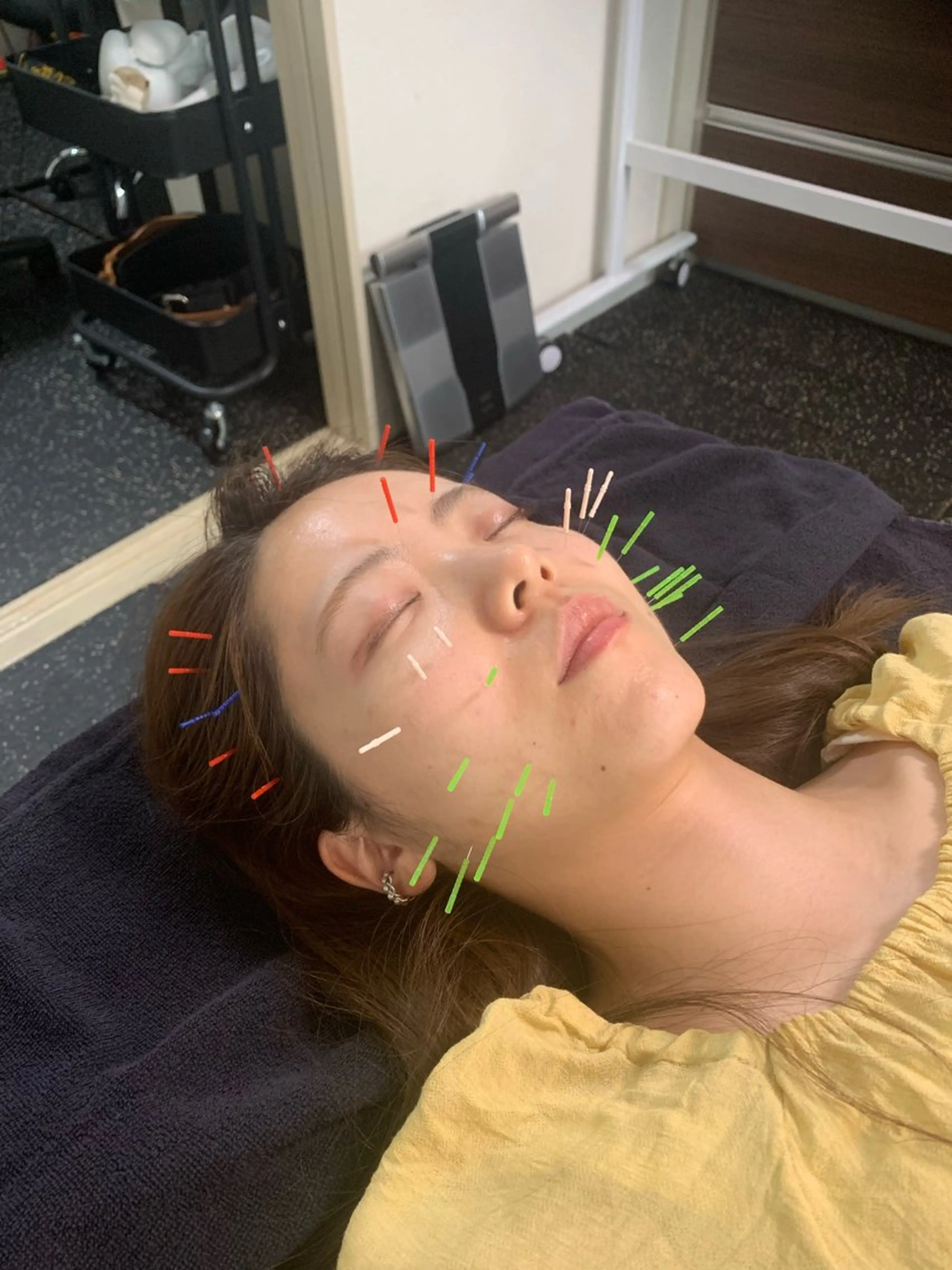 エステ リラク 小顔矯正・美容鍼 FLOW鍼灸整体院のエステ・リラクイメージ