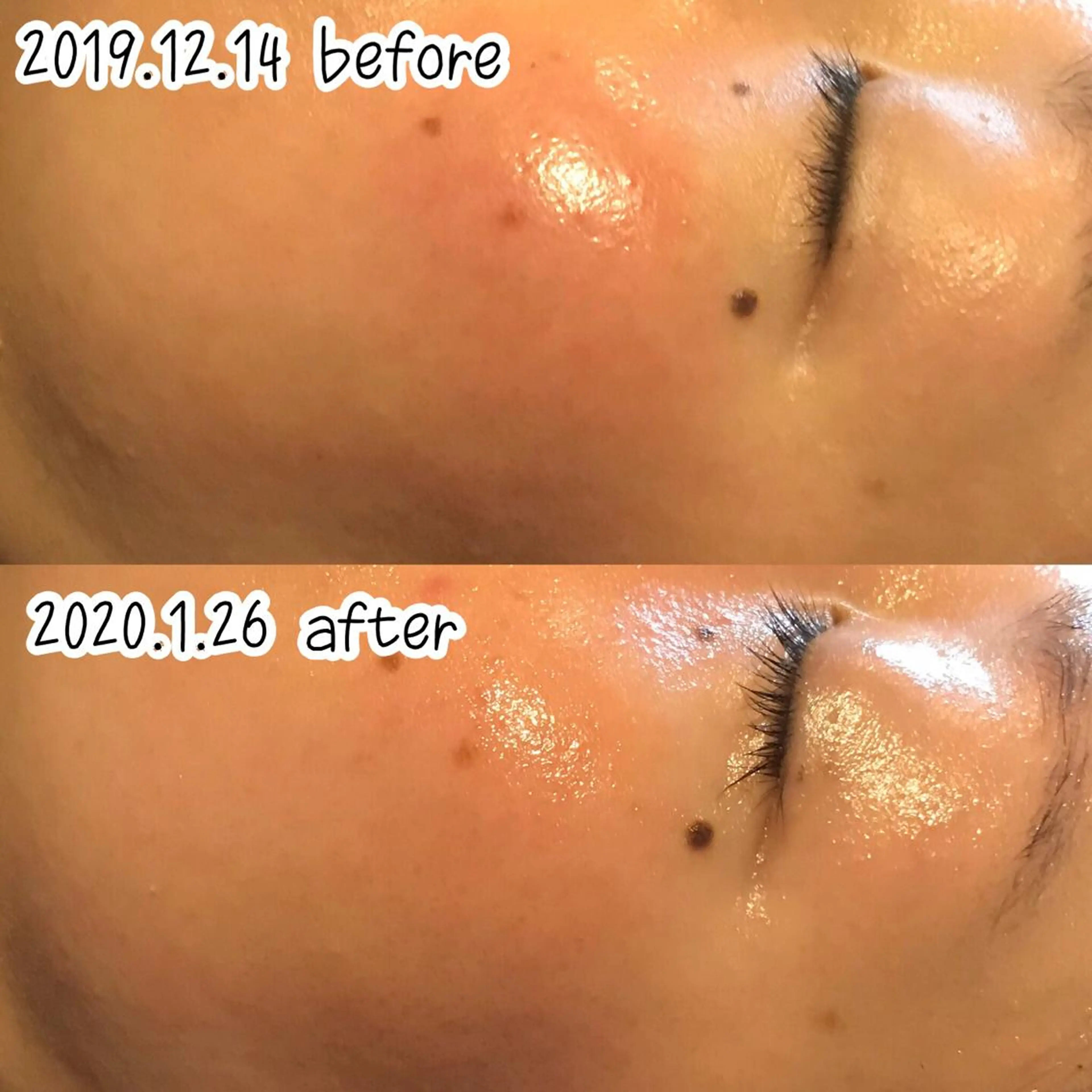 エステ 浜野 恵美のエステ・リラクイメージ