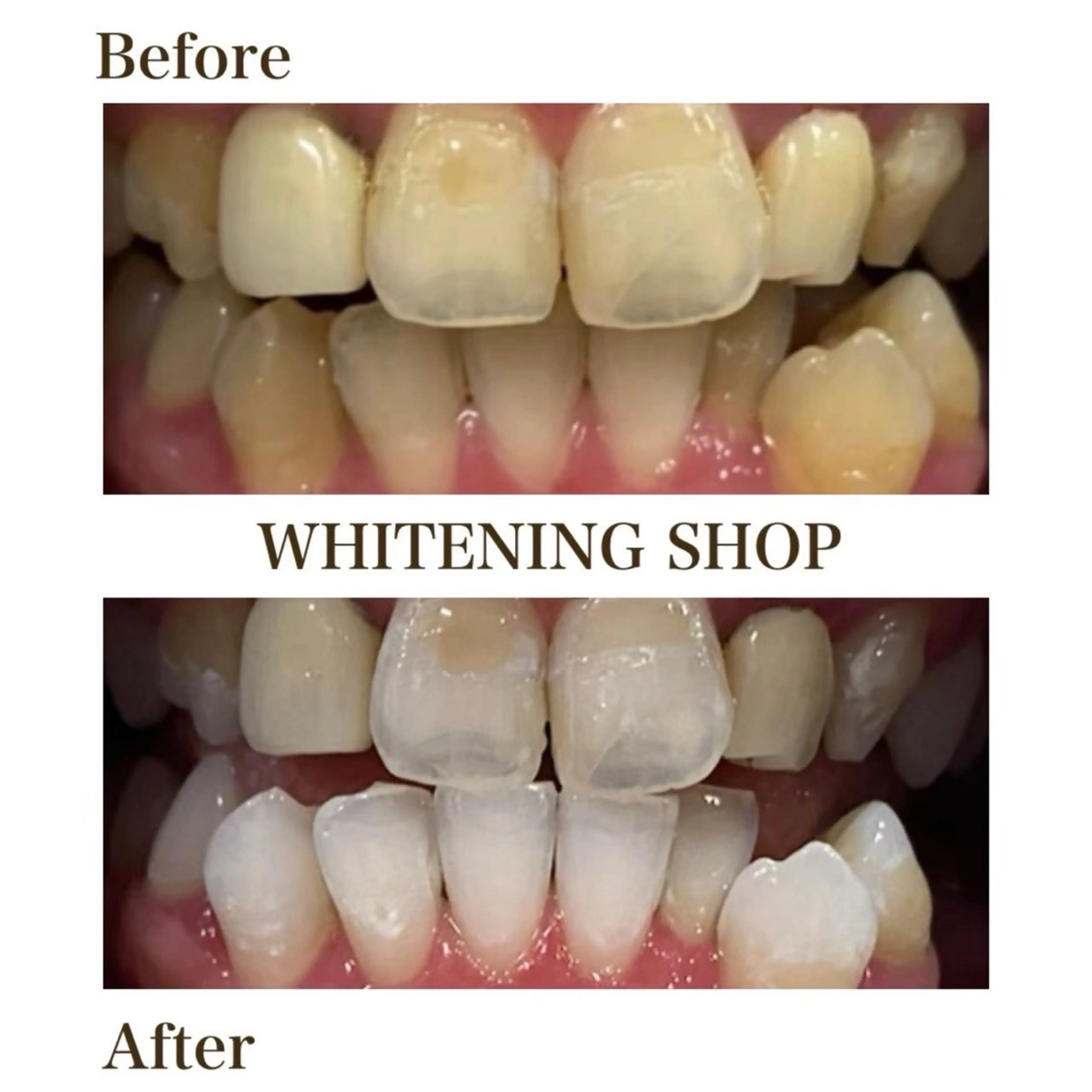 メンズ ホワイトニング ショップ葵区静岡駅店のその他イメージ