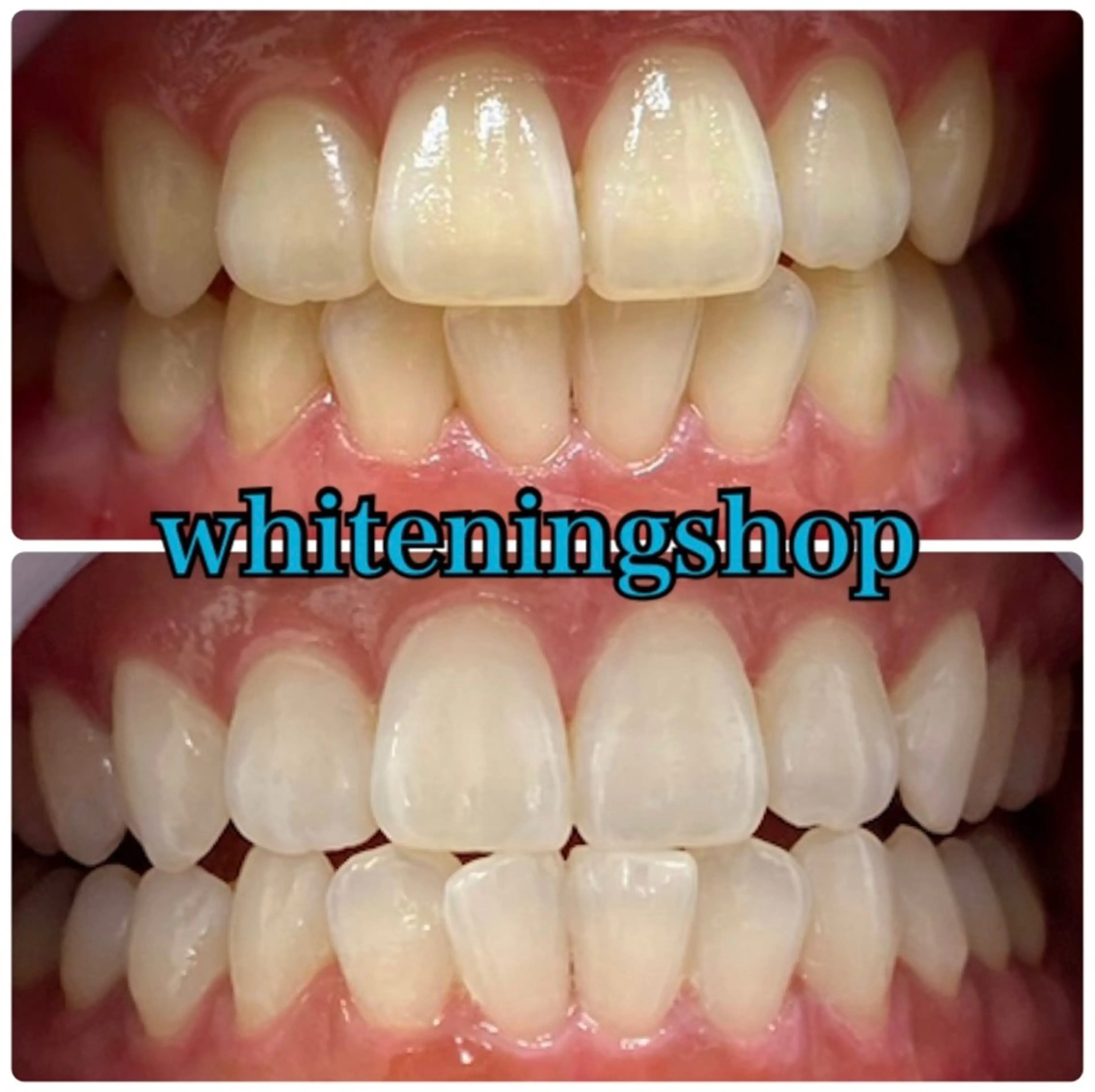 エステ リラク ホワイトニング ショップ吉祥寺店のエステ・リラクイメージ