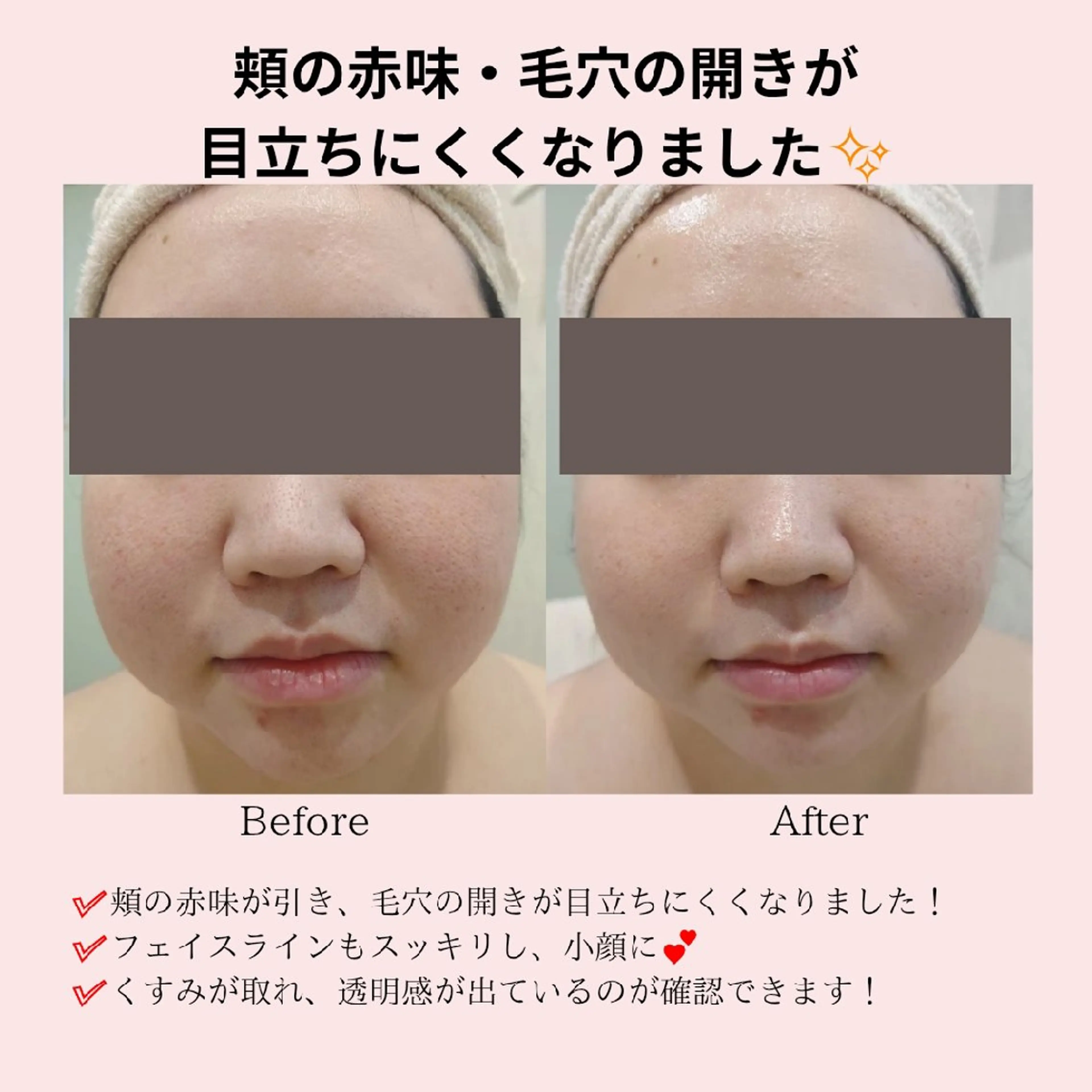 エステ PRETTIEST SHINE所属・フェイシャル/ボディ /ブライダル山田浩子のエステ・リラクイメージ