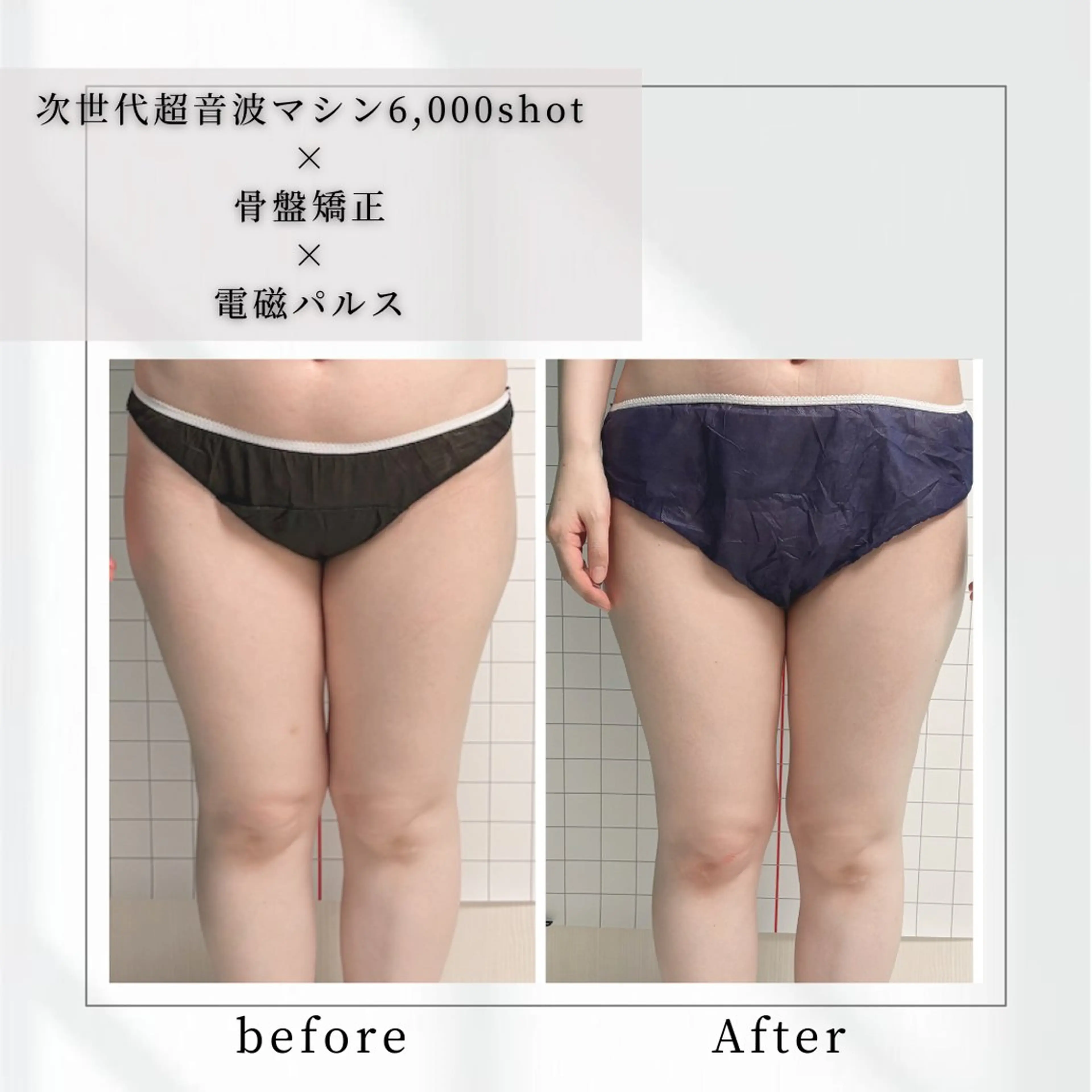 小顔矯正専門店 【RED】池田のエステ・リラクイメージ