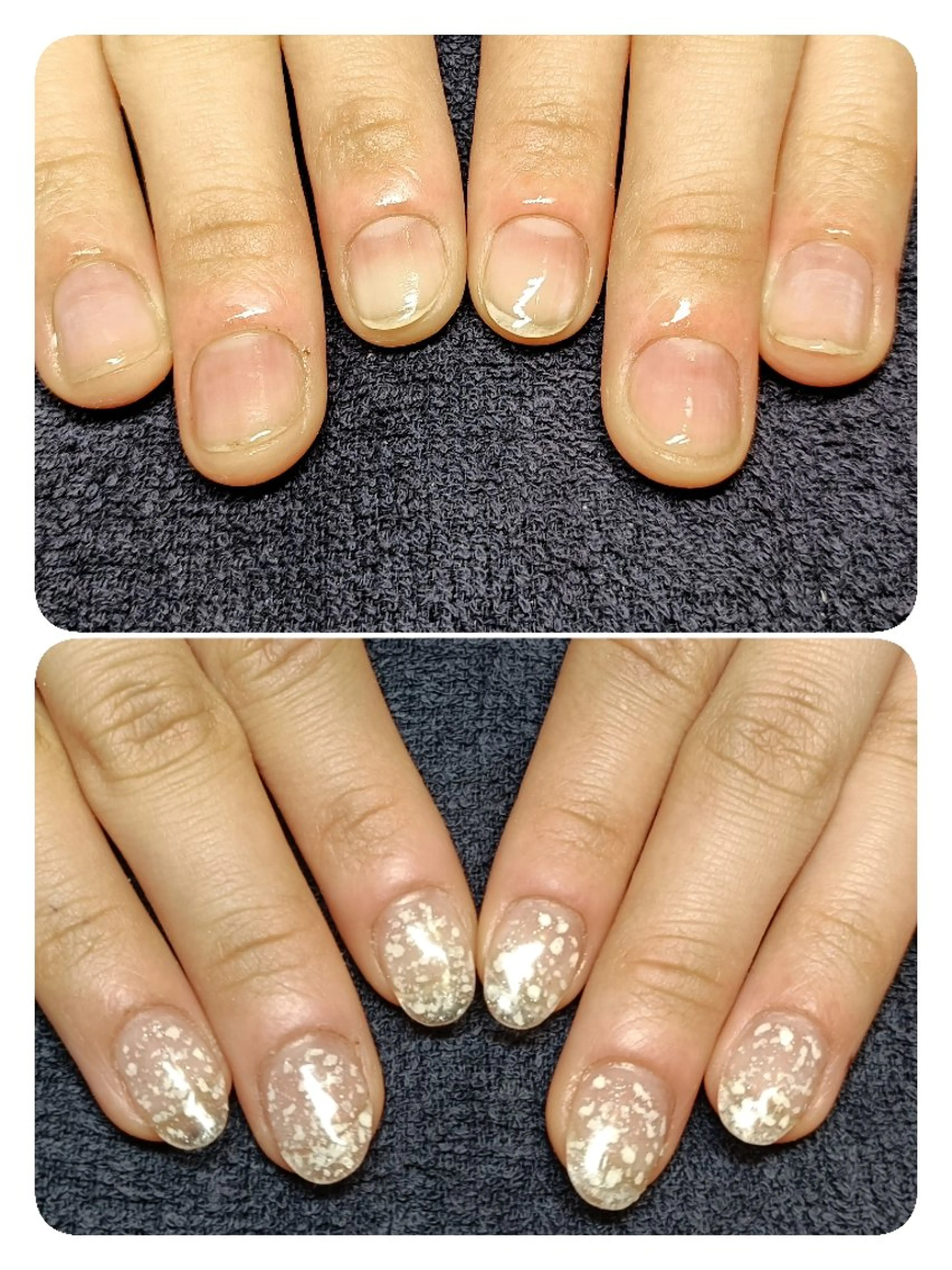 ネイル ハンドネイル ハンドケア 深爪矯正/爪育成ケア manie nailのネイルデザイン