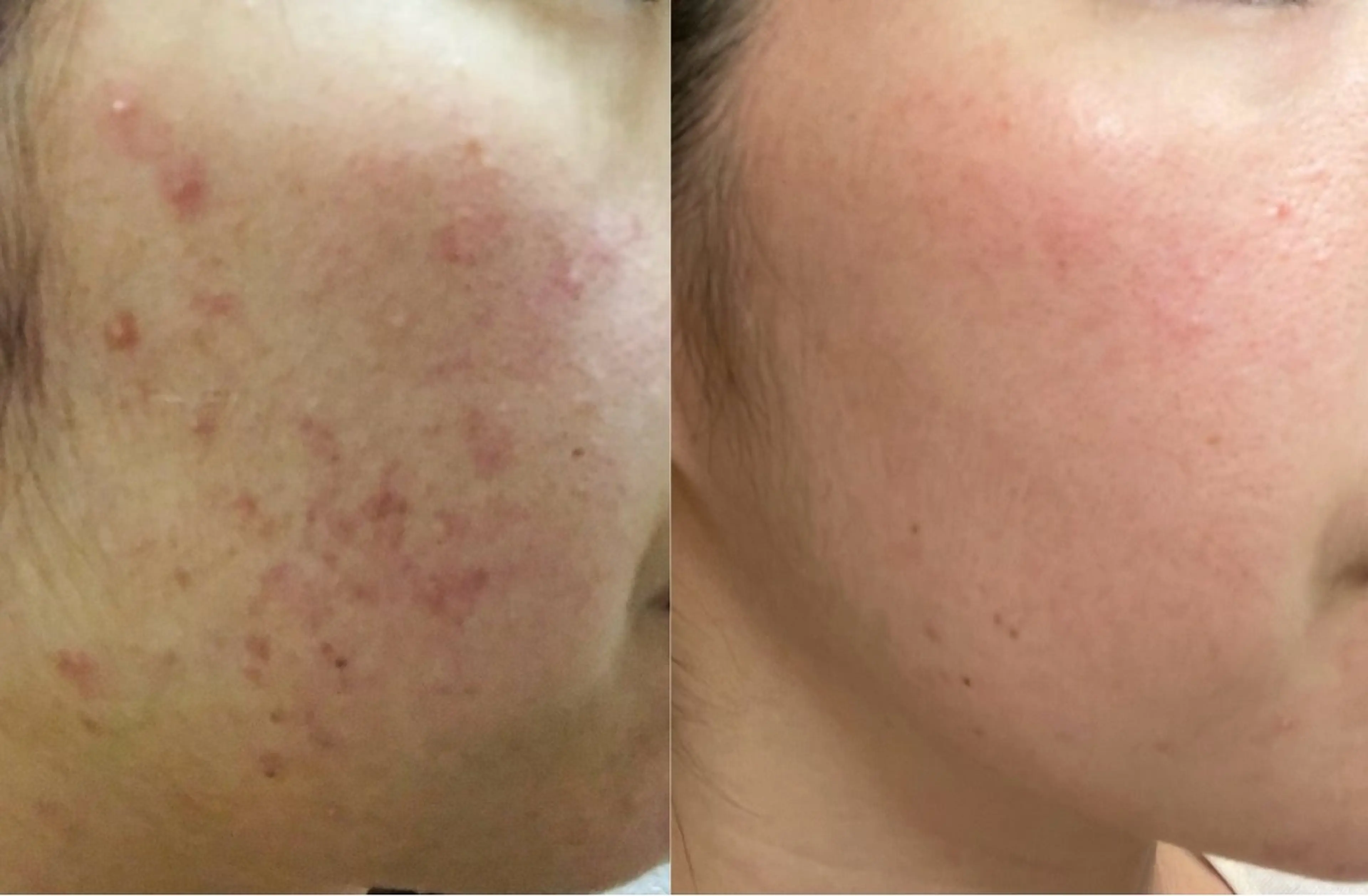 Belchic ベルシックのエステ・リラクイメージ