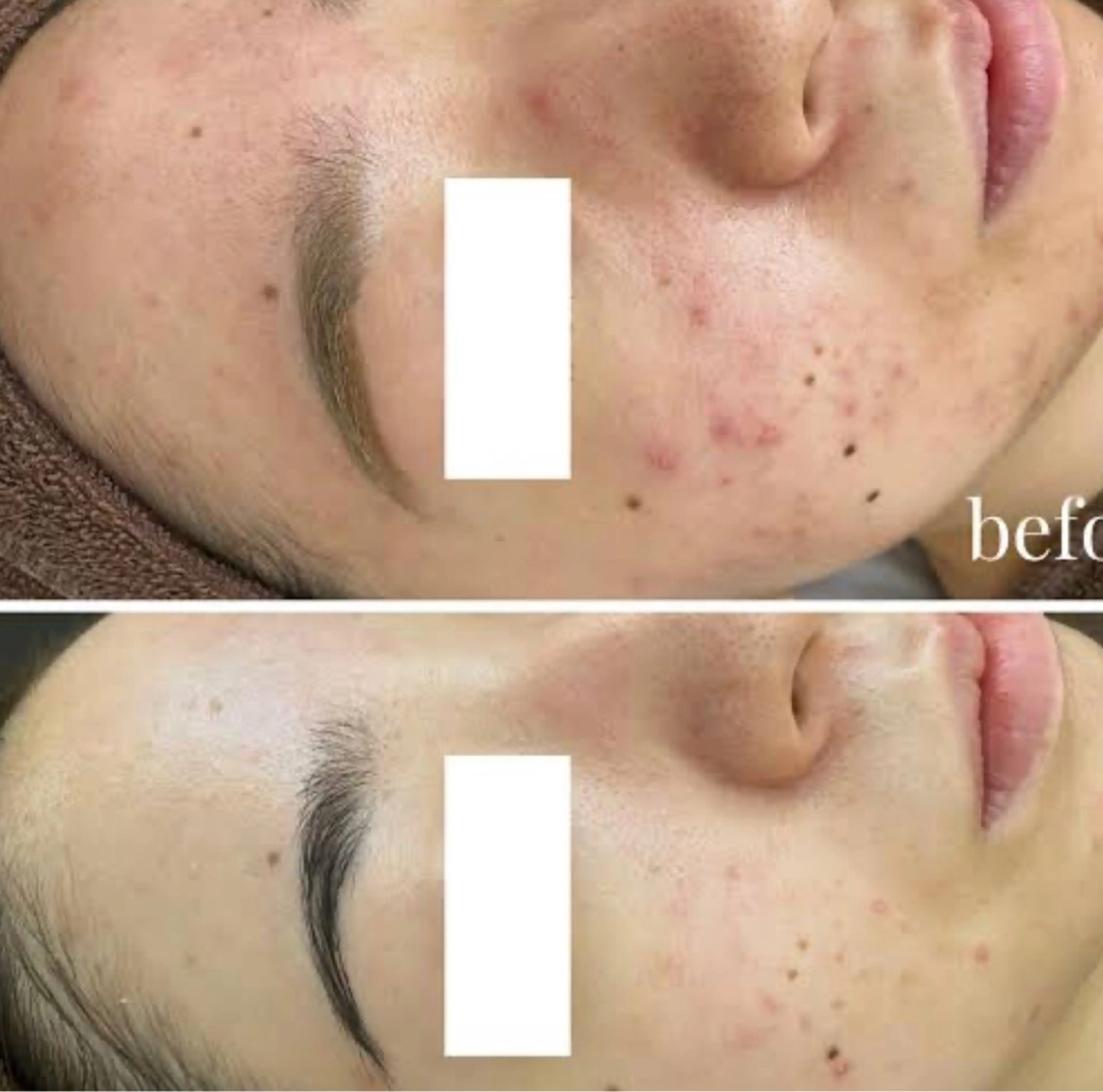 エステ ☺ハーブピール💕 ソフィアカロン💖のエステ・リラクイメージ