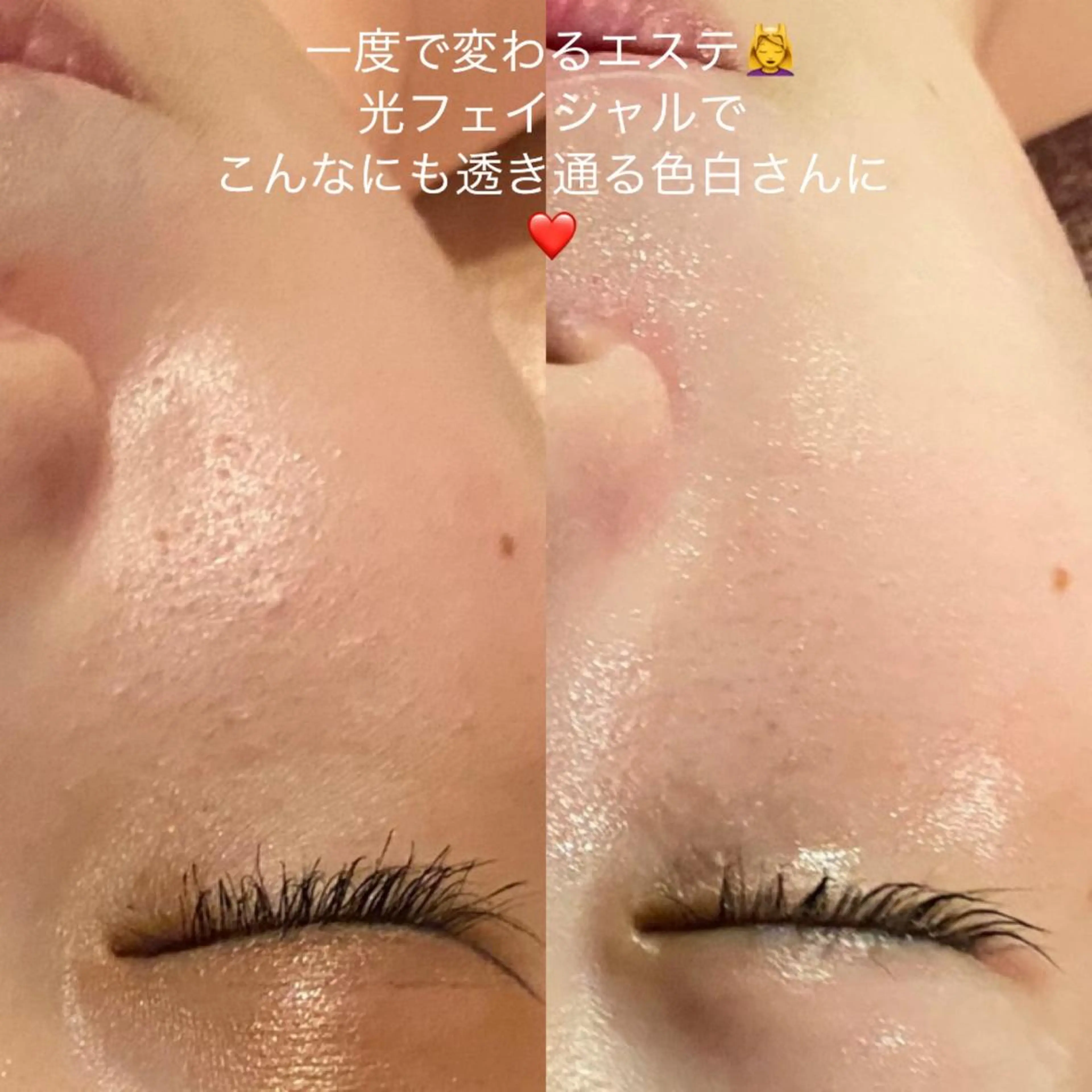 エステ 毛穴から始める肌メン テマンダリンオレンジのエステ・リラクイメージ