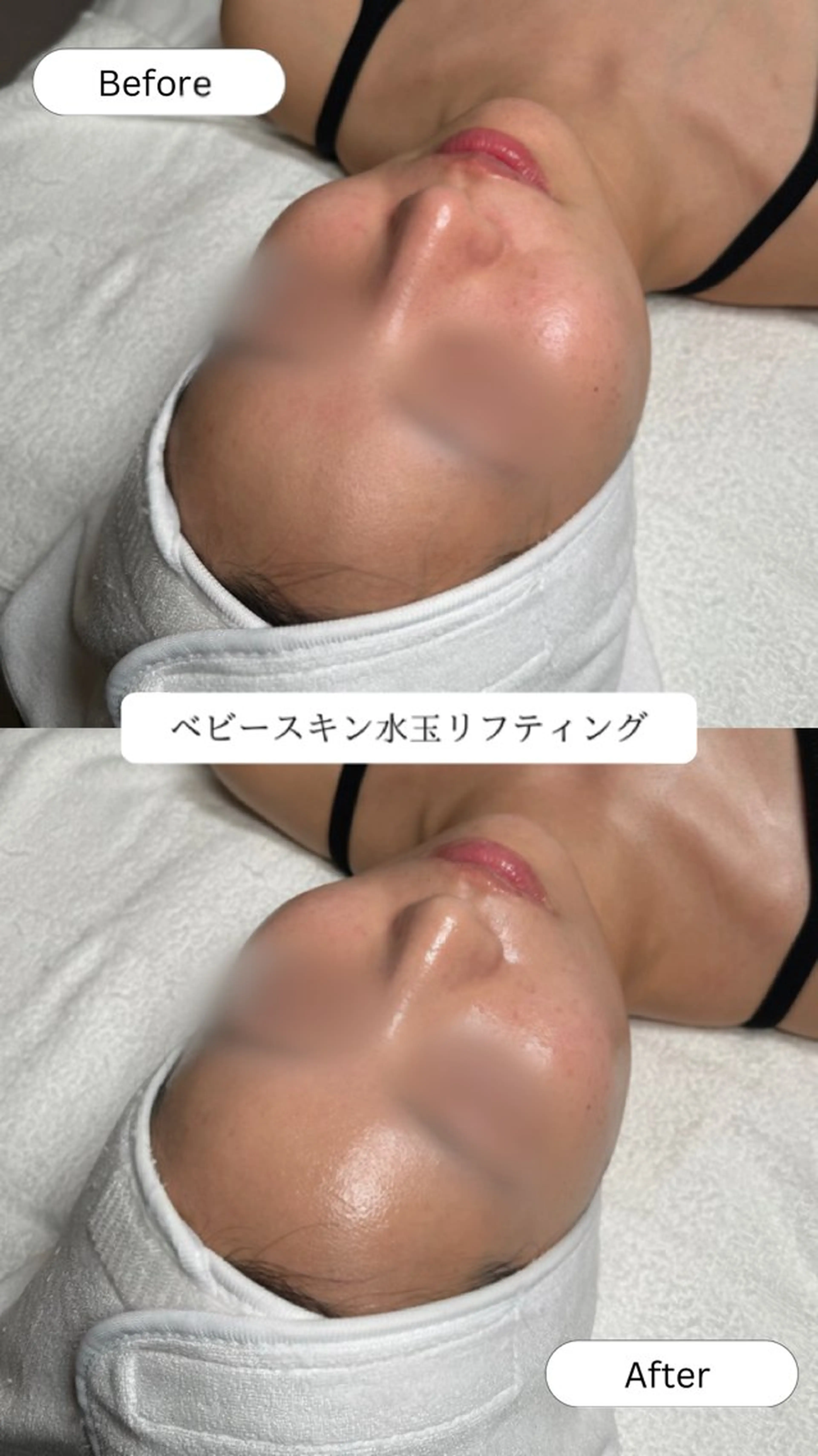 韓国肌管理🫧LDM 🫧Junnaのエステ・リラクイメージ