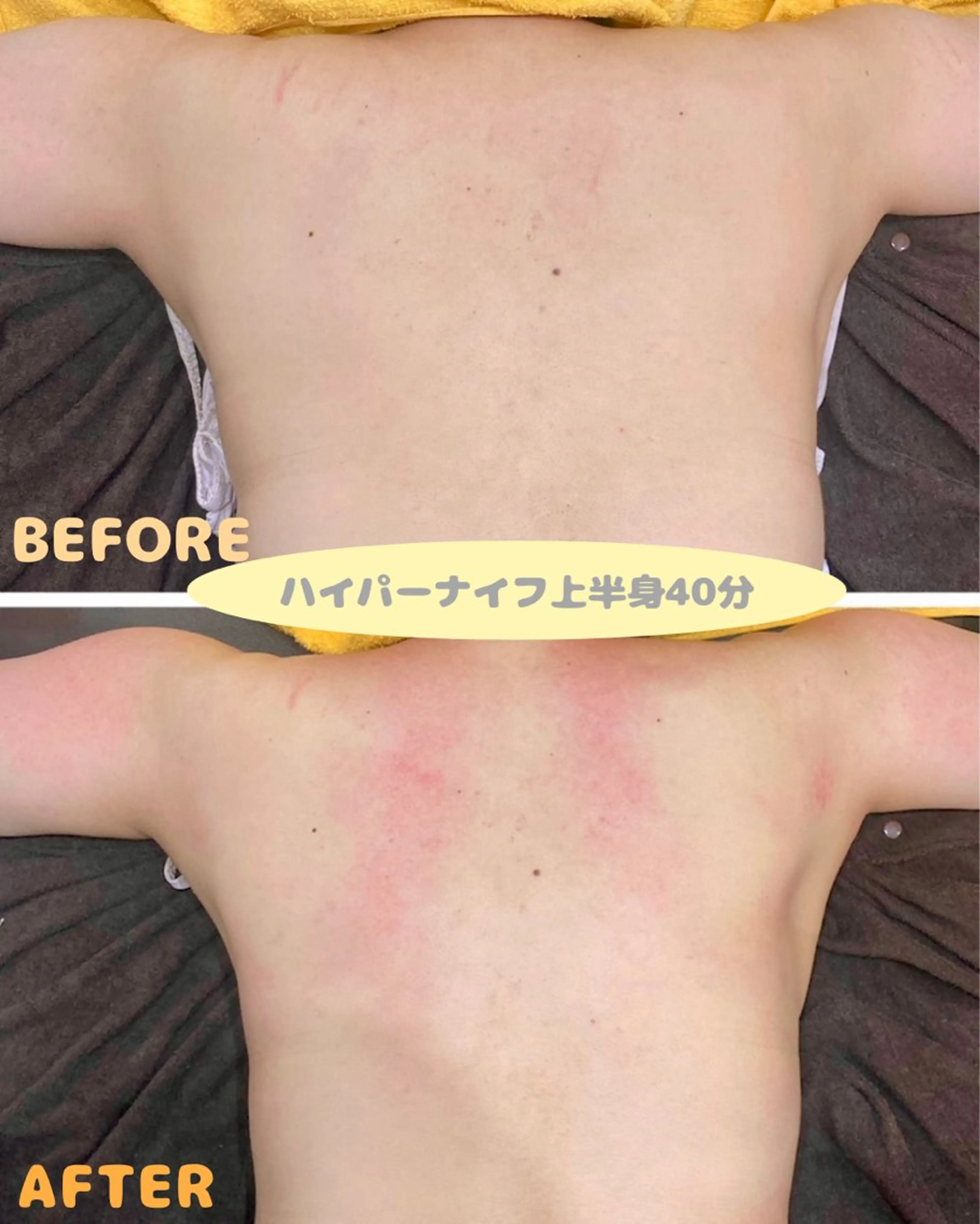 lucia  豊明 肌管理のエステ・リラクイメージ