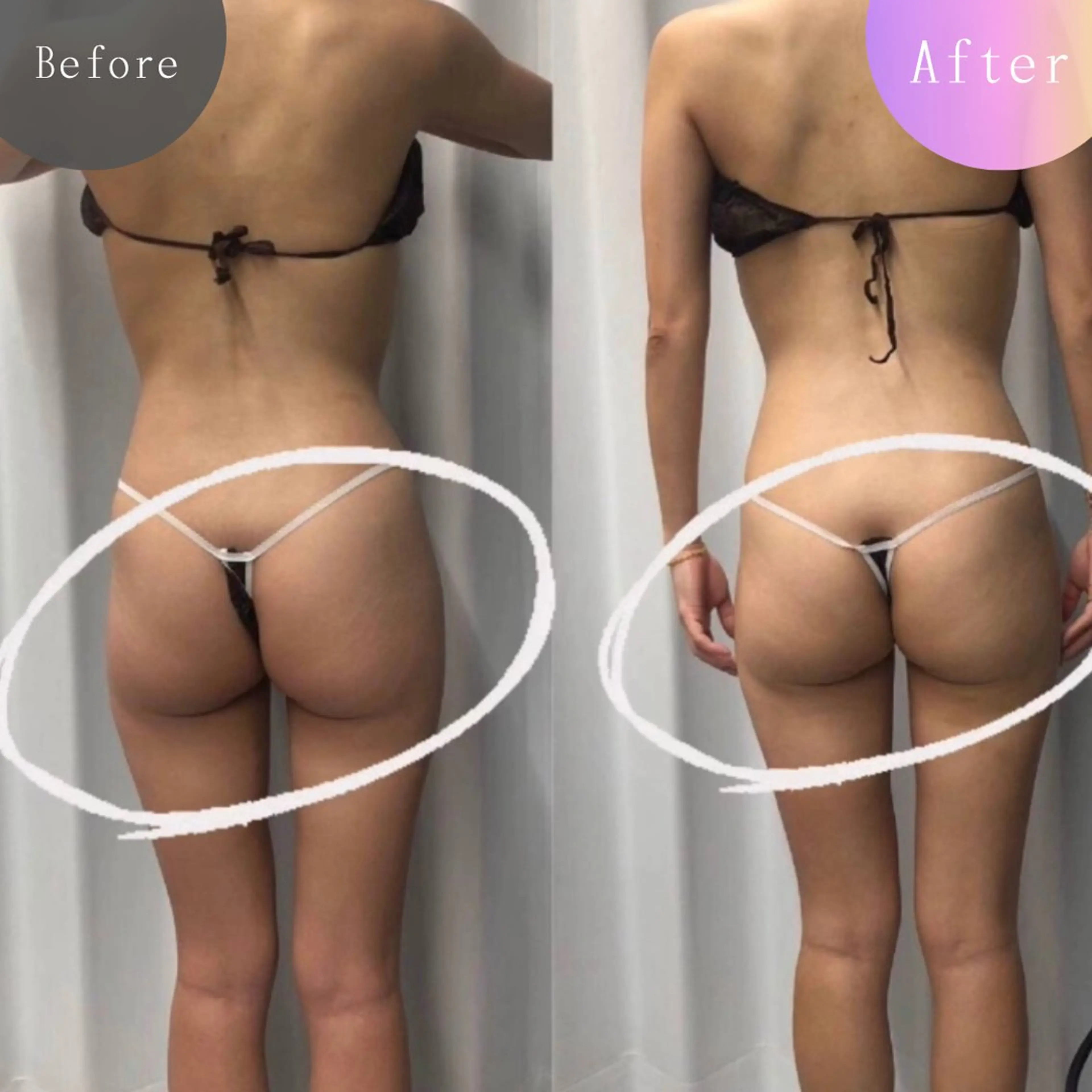 美容整体・塗る漢方・フェイシャルRechica所属・痩身・脱毛・肌管理 Rechica心斎橋のエステ・リラクイメージ