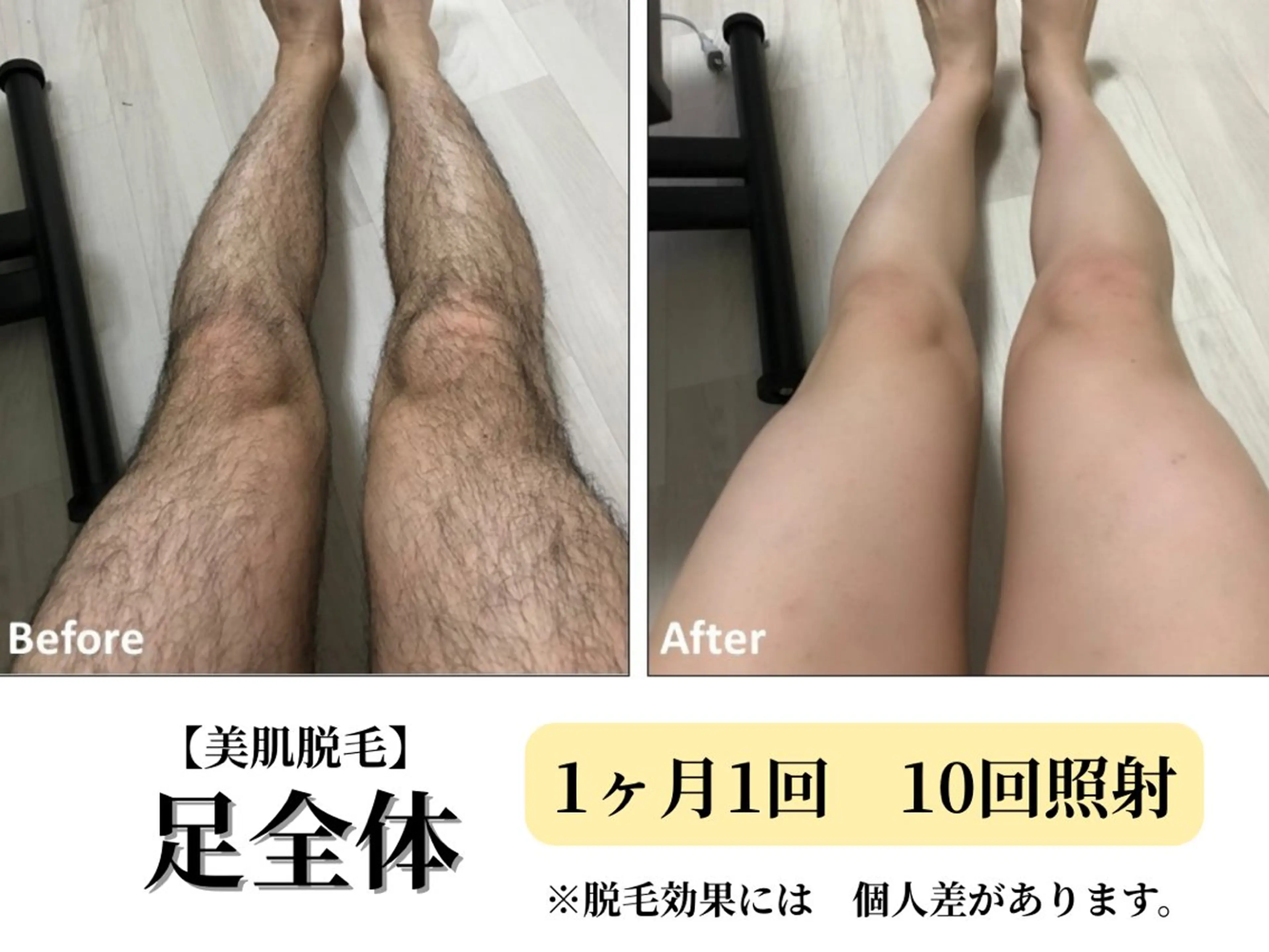 脱毛 Belle White所属・本格痩身＊透明美肌 BelleWhiteのエステ・リラクイメージ