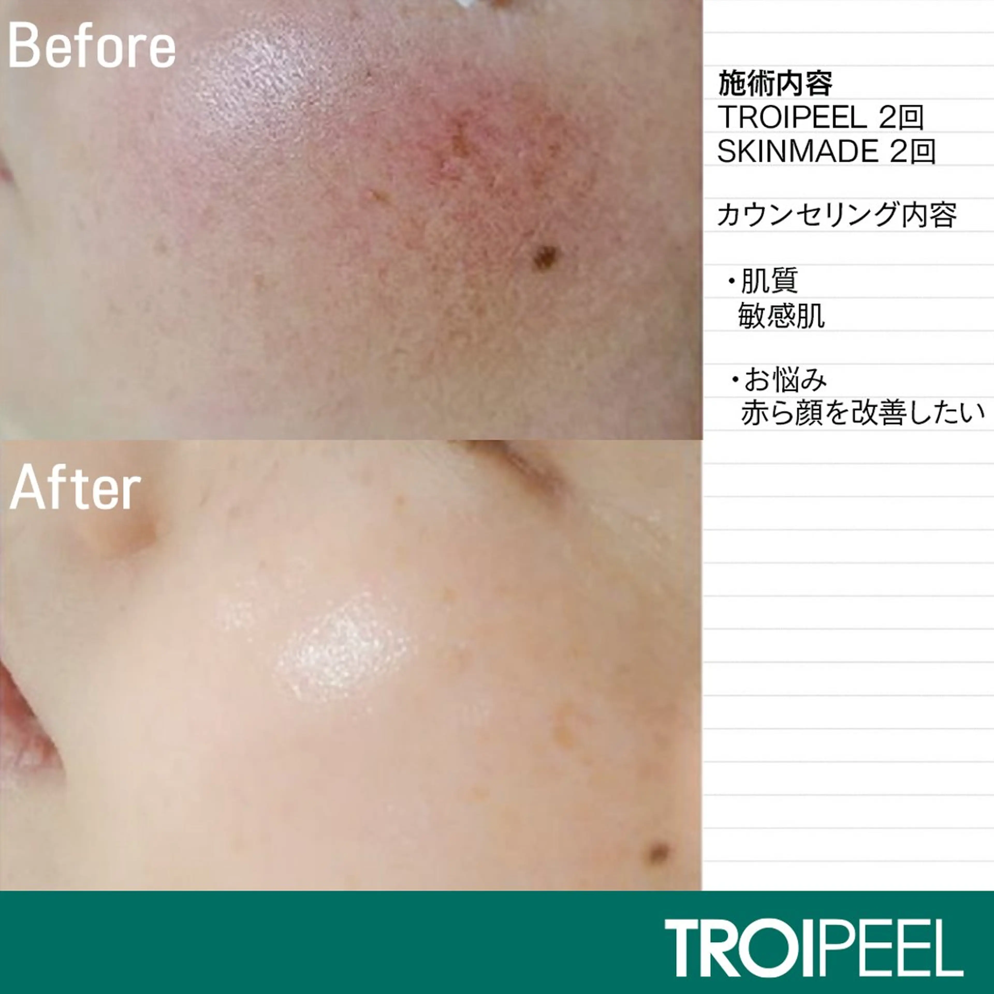 トロイアルケ🩵 美眉EMIの眉毛・アイブロウイメージ