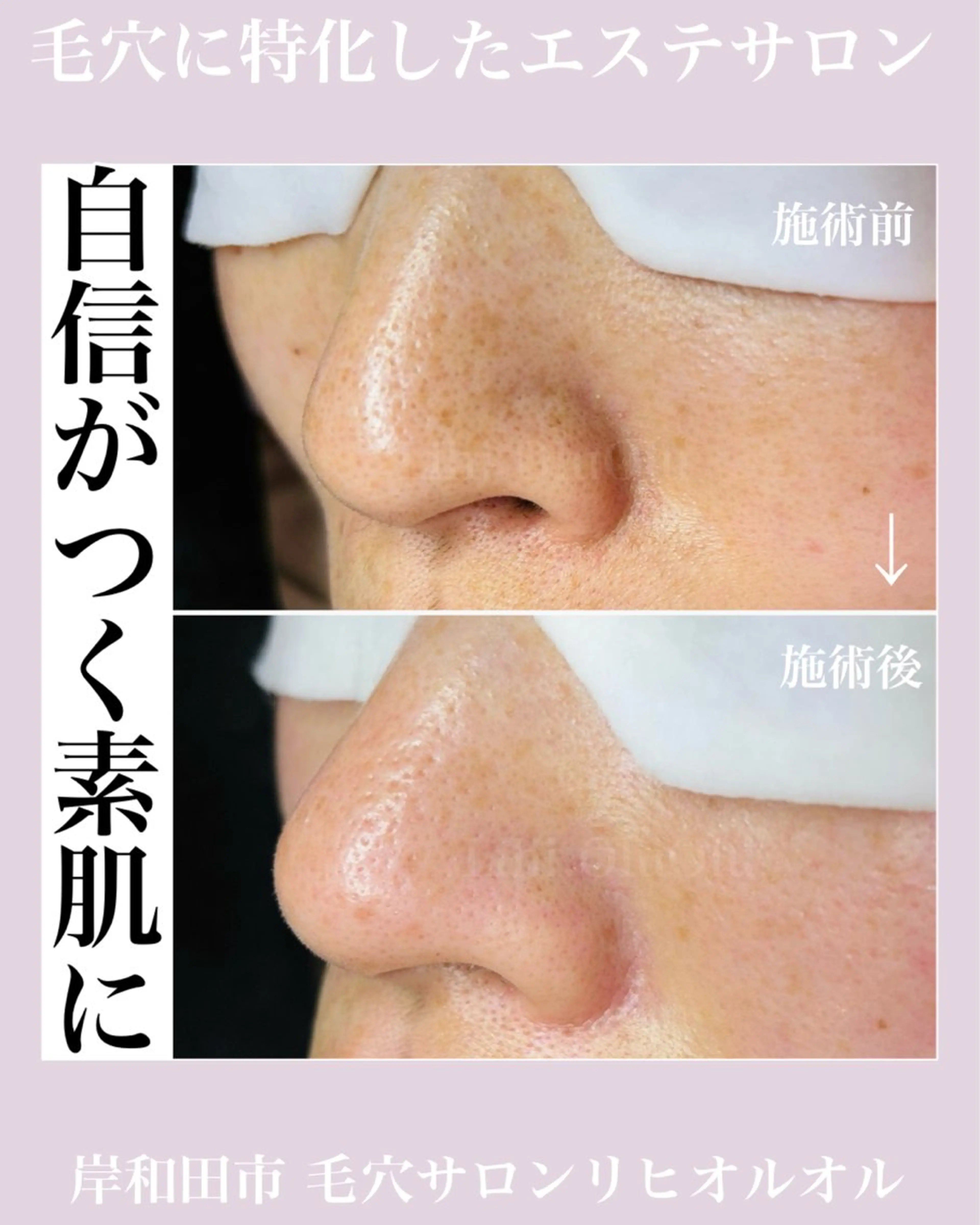 毛穴汚れ改善専門店/ 岸和田/リヒオルオルのエステ・リラクイメージ