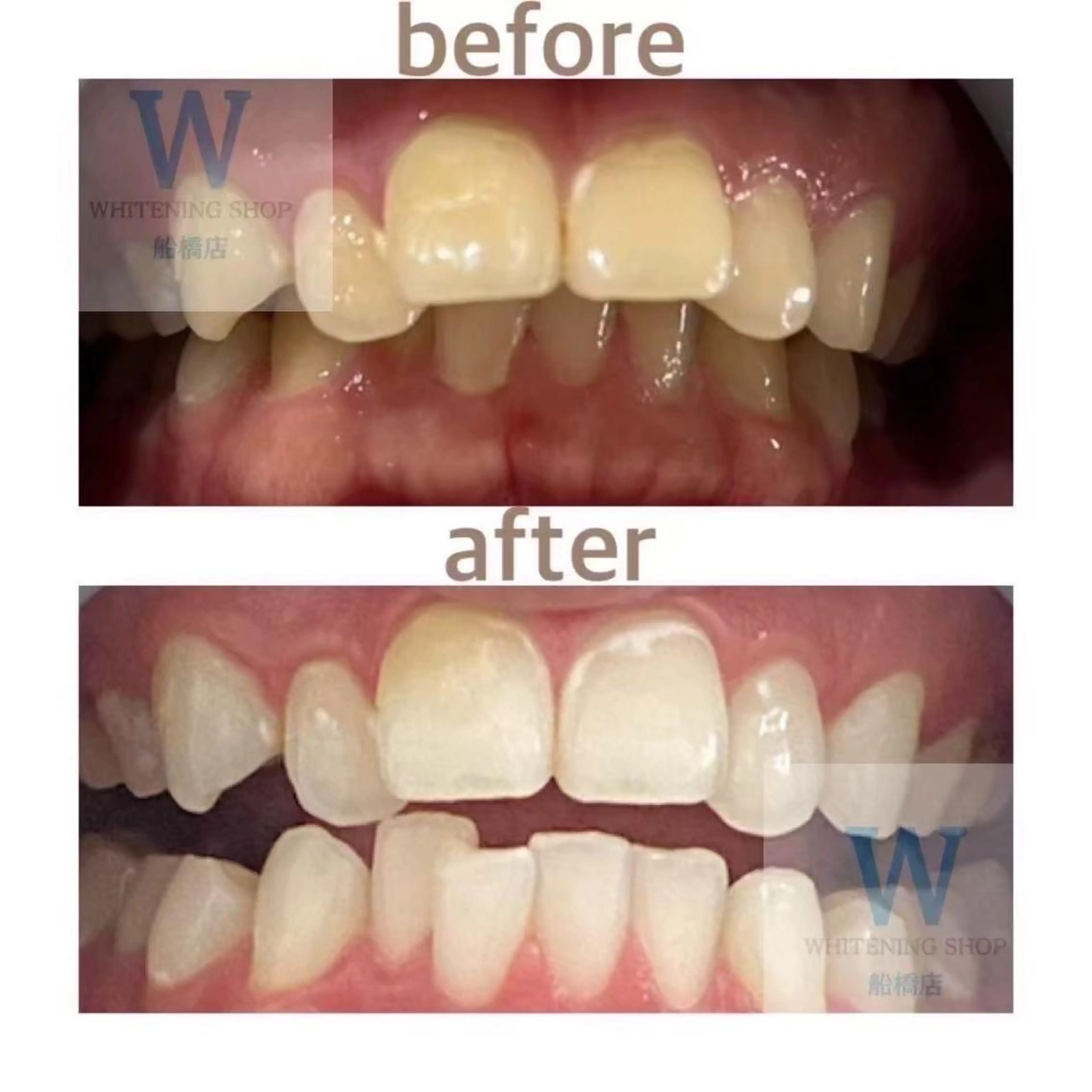 ホワイトニング ショップ船橋２号店のエステ・リラクイメージ