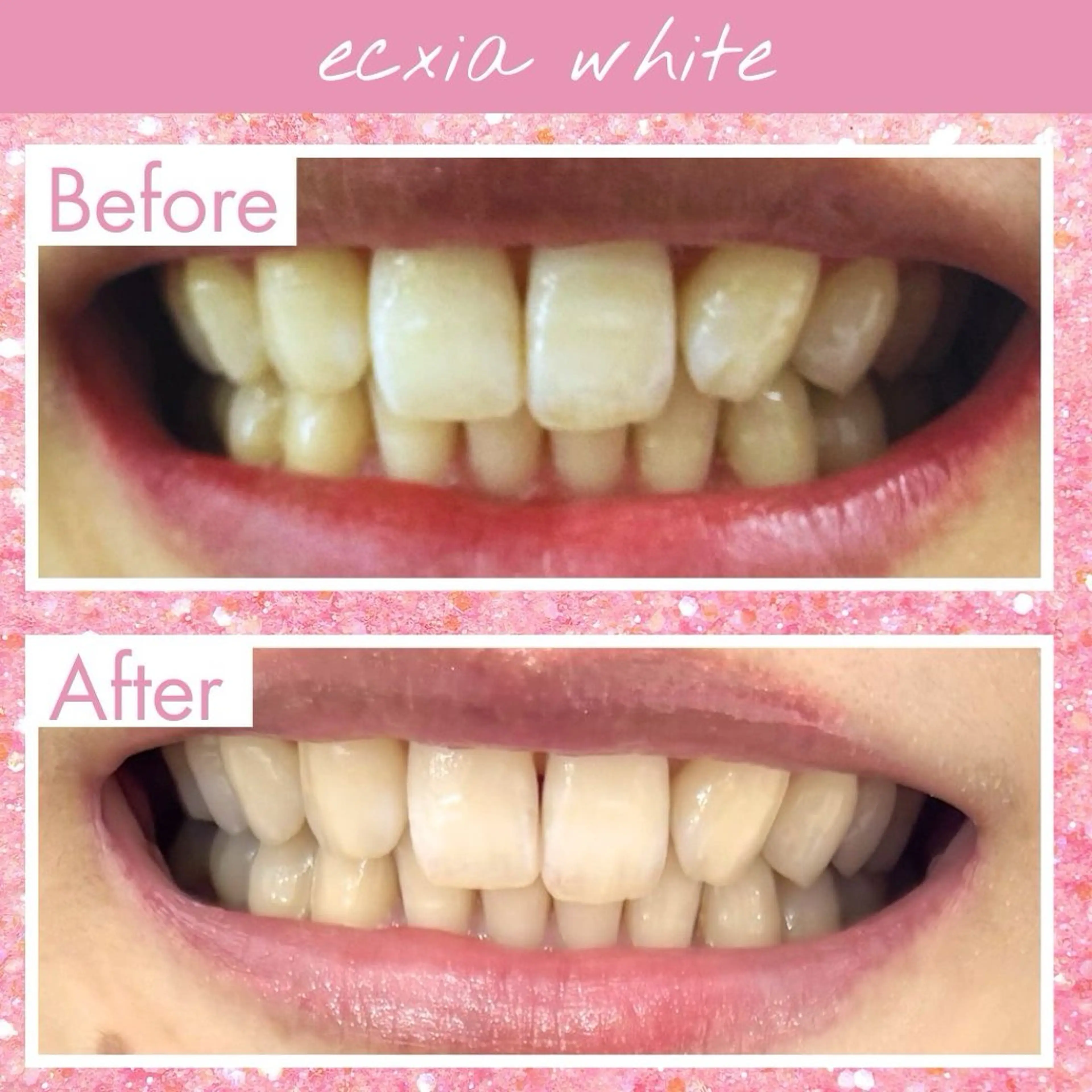 セルフホワイトニング エクシア大府店のその他イメージ