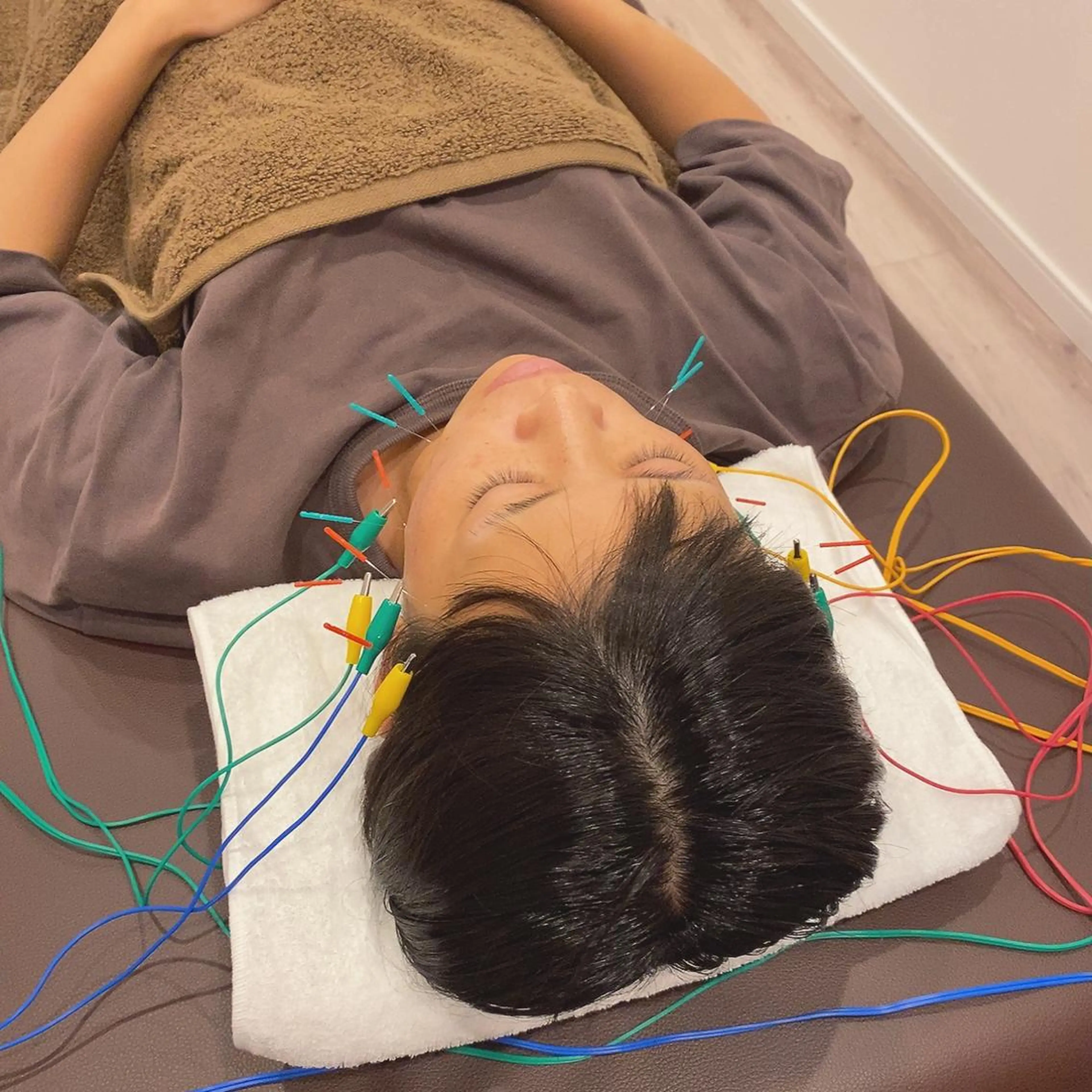 美容鍼灸Solana所属・肌質改善×美容鍼 ゆいのエステ・リラクイメージ