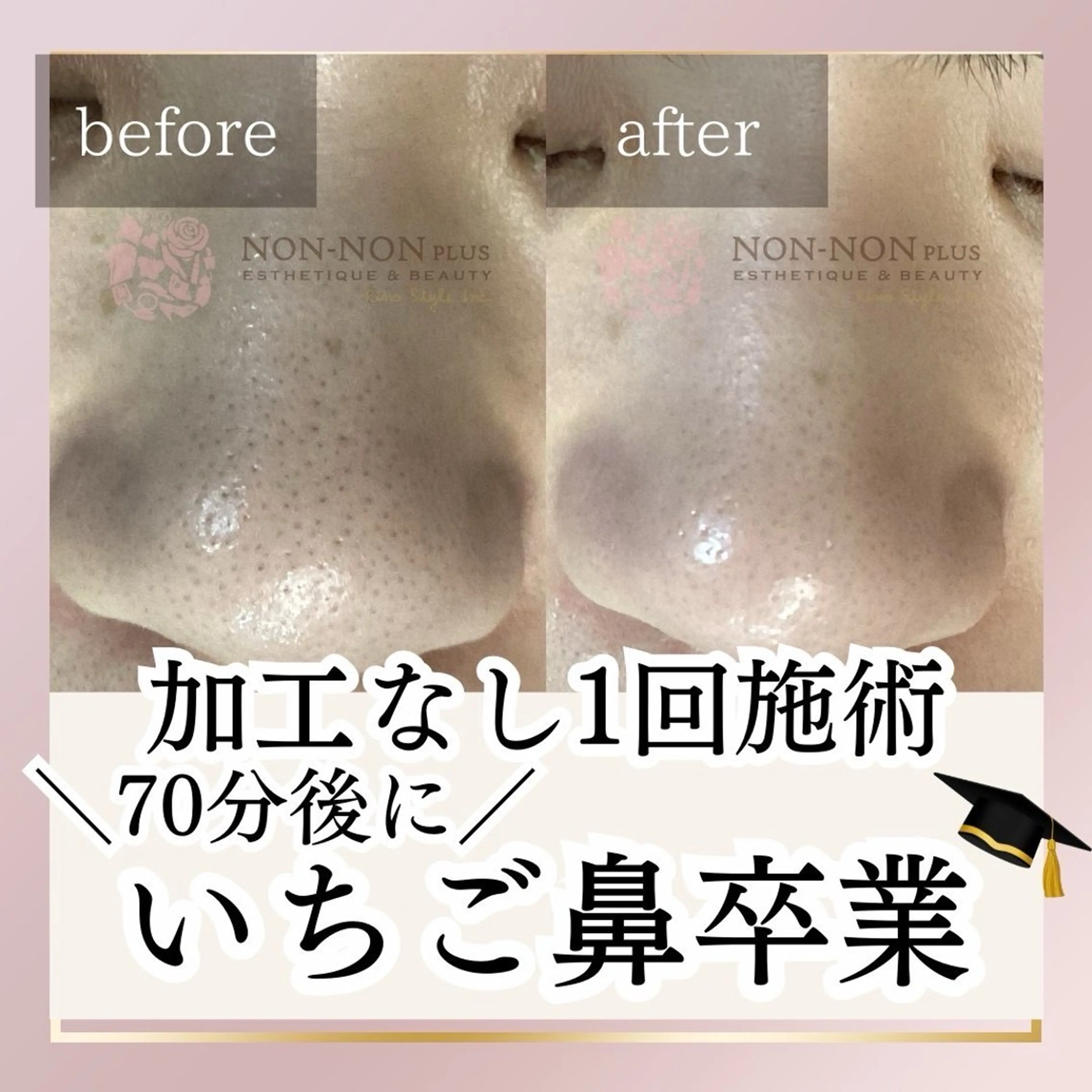 NON-NONプラス 大人の本気痩身のエステ・リラクイメージ