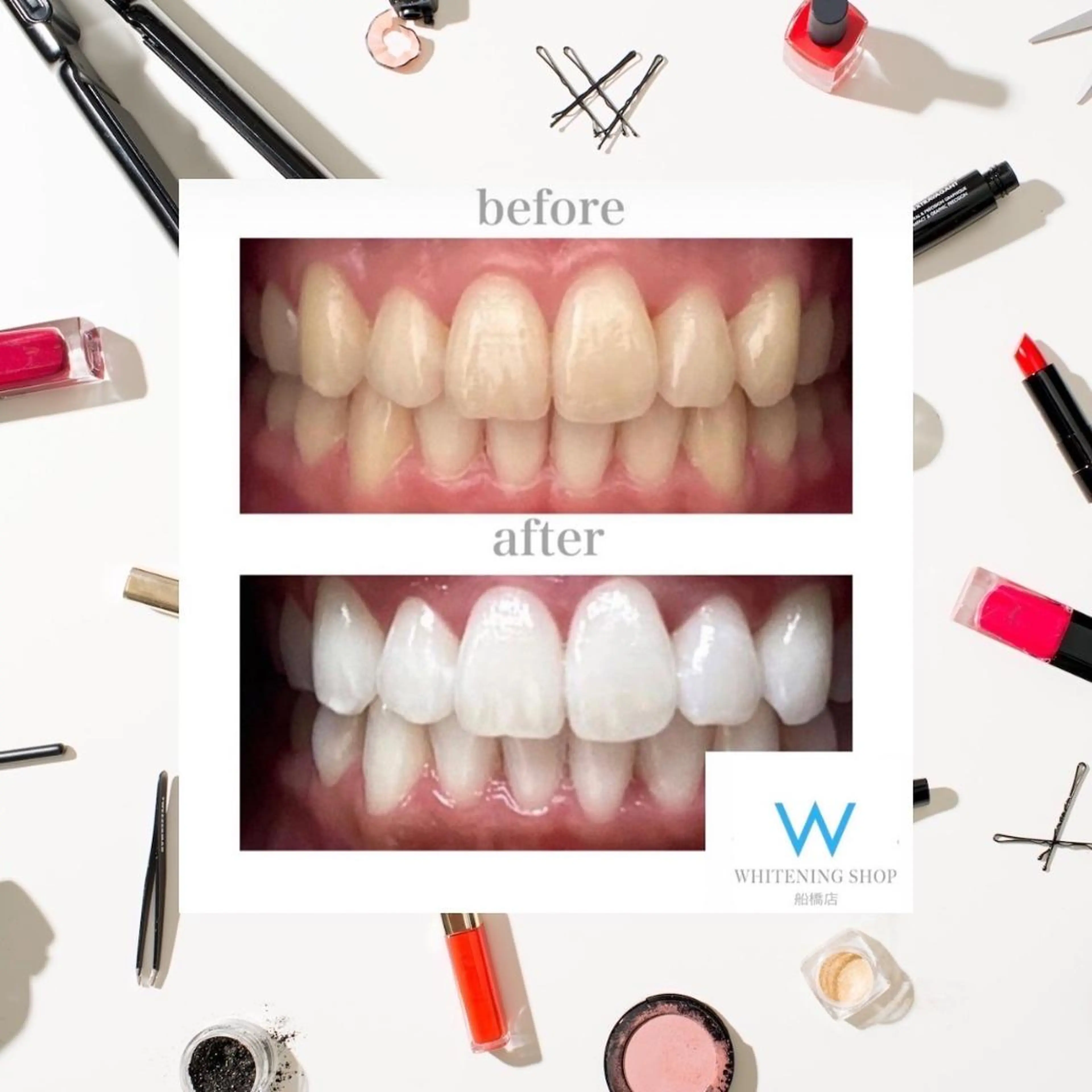 メンズ その他 ホワイトニング ショップ本八幡店のエステ・リラクイメージ