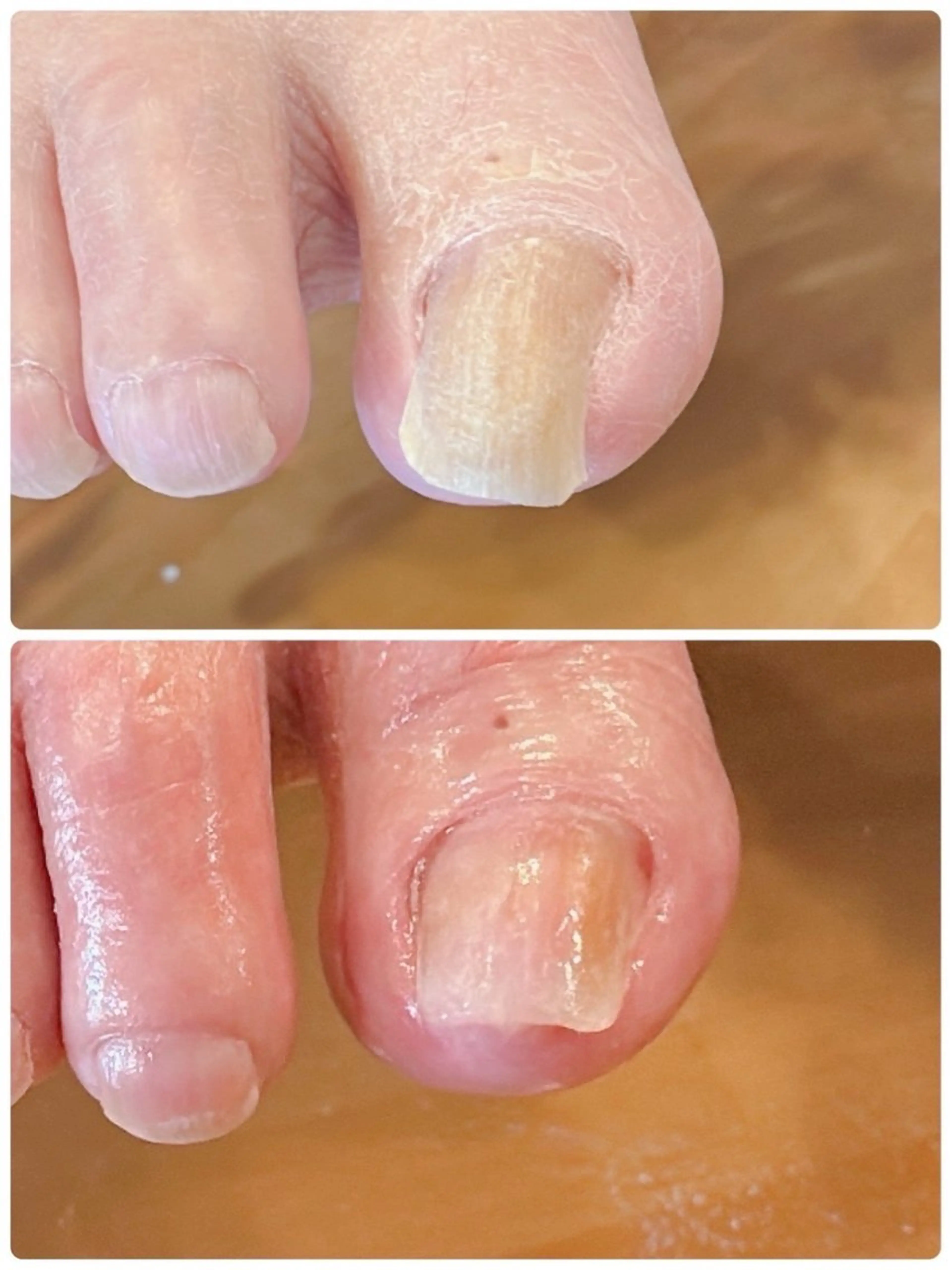 ネイル Alo.nail アロ•ネイルのネイルデザイン