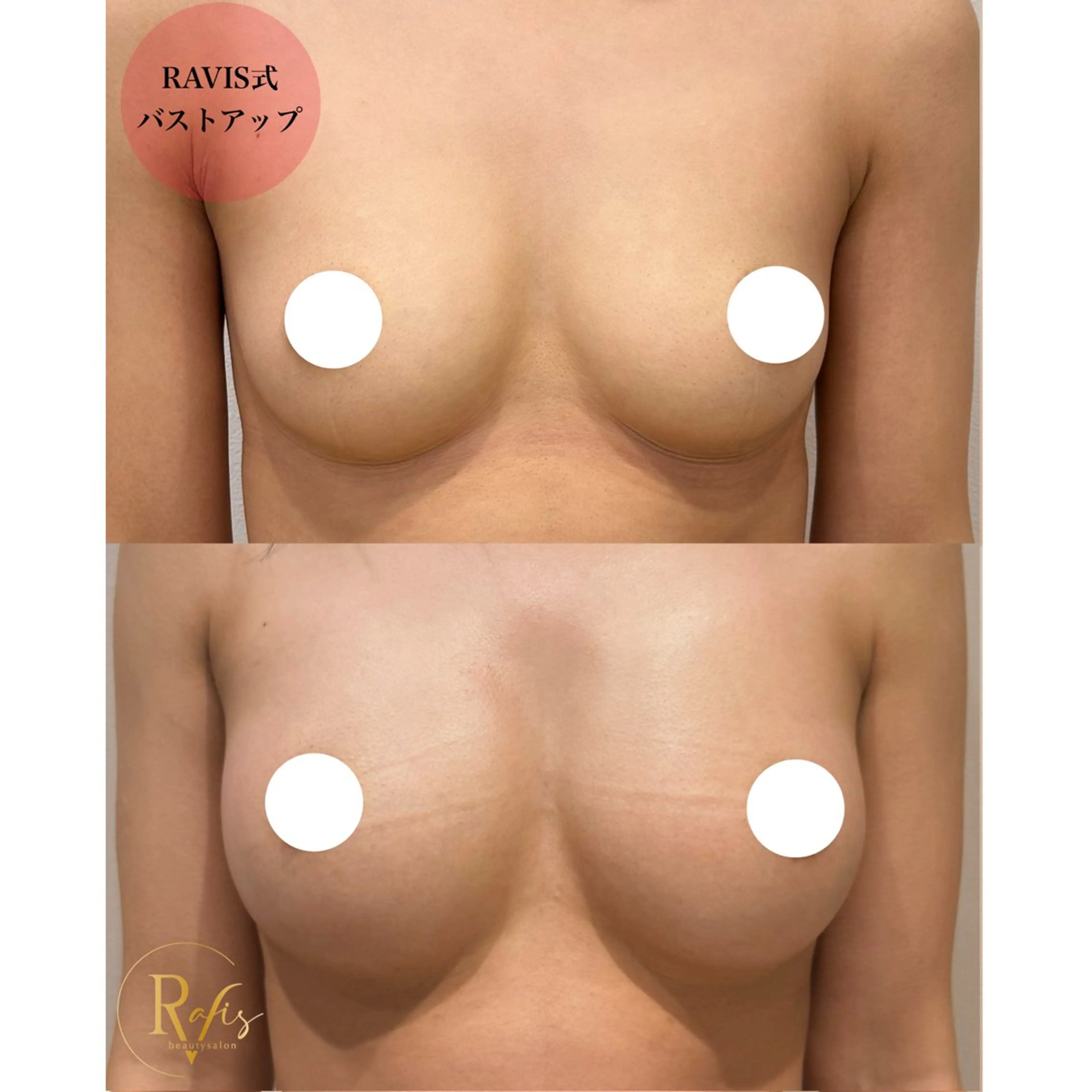 エステ 東大阪/韓国肌管理/ 痩身バスト専門店のエステ・リラクイメージ