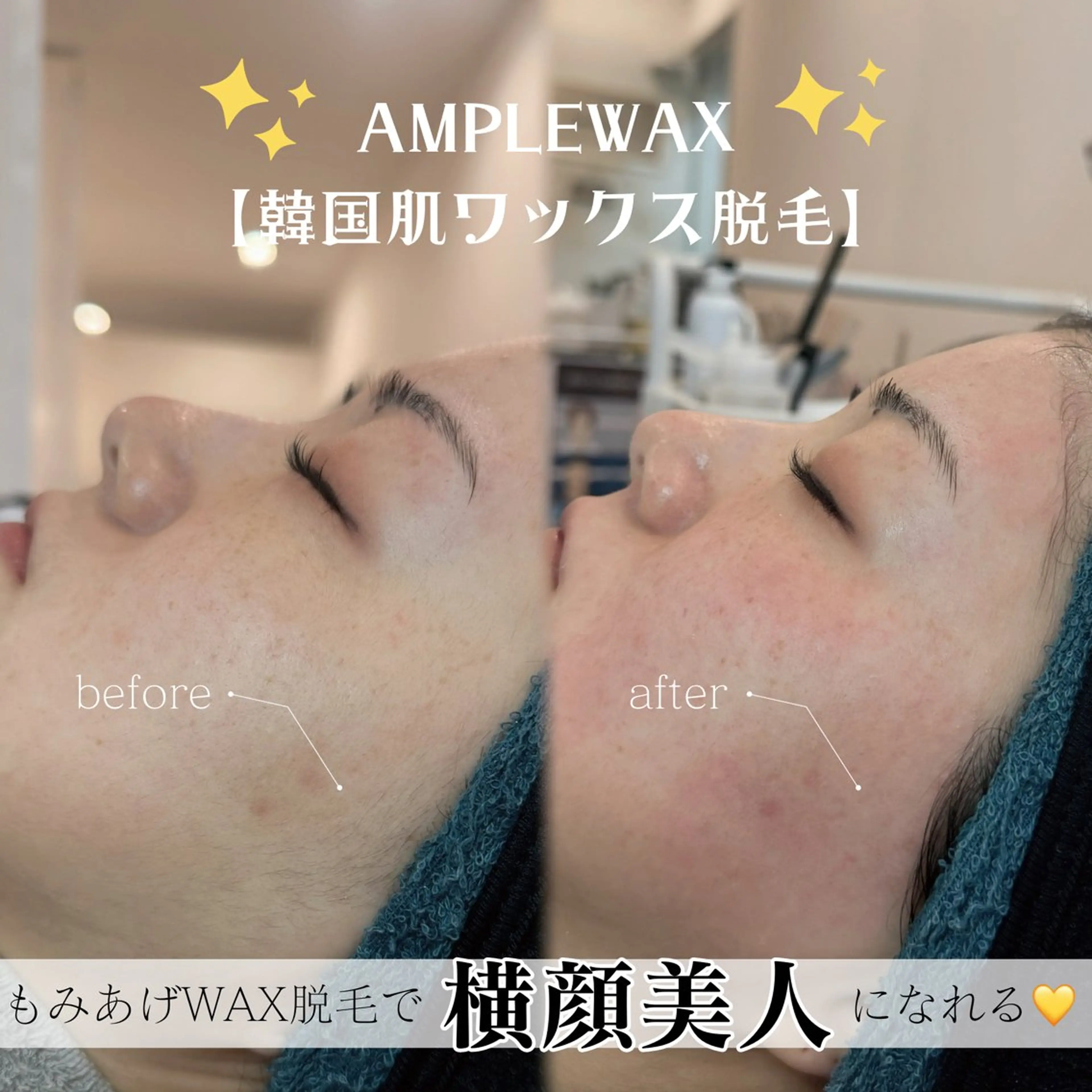 アイブロウ Lea堺東　毛穴洗浄 ×顔ワックス脱毛のその他イメージ
