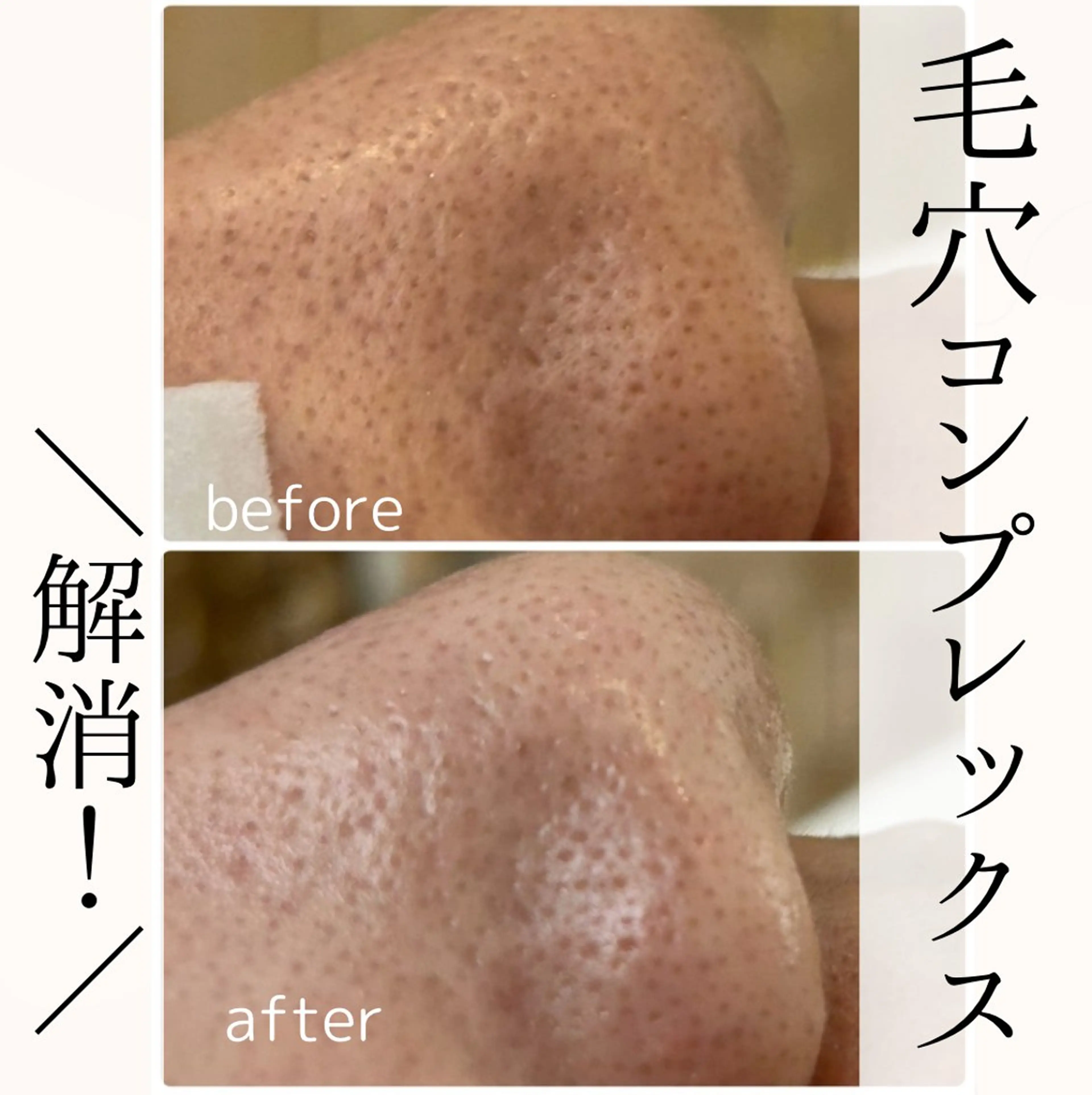 エステ 小顔・毛穴・たるみ ネイル　似内真樹のエステ・リラクイメージ