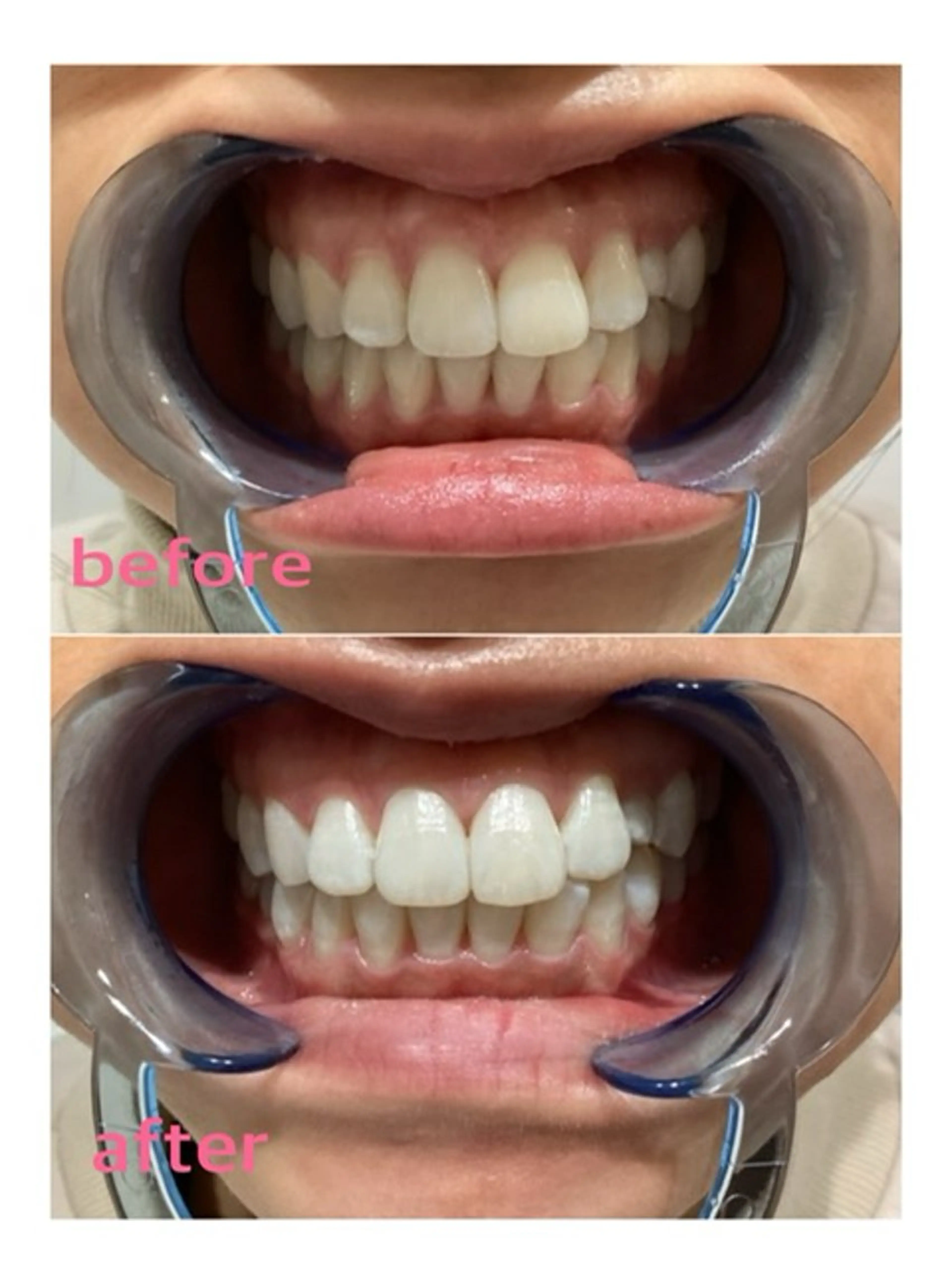 その他 Pullulant EstheKyotoのエステ・リラクイメージ