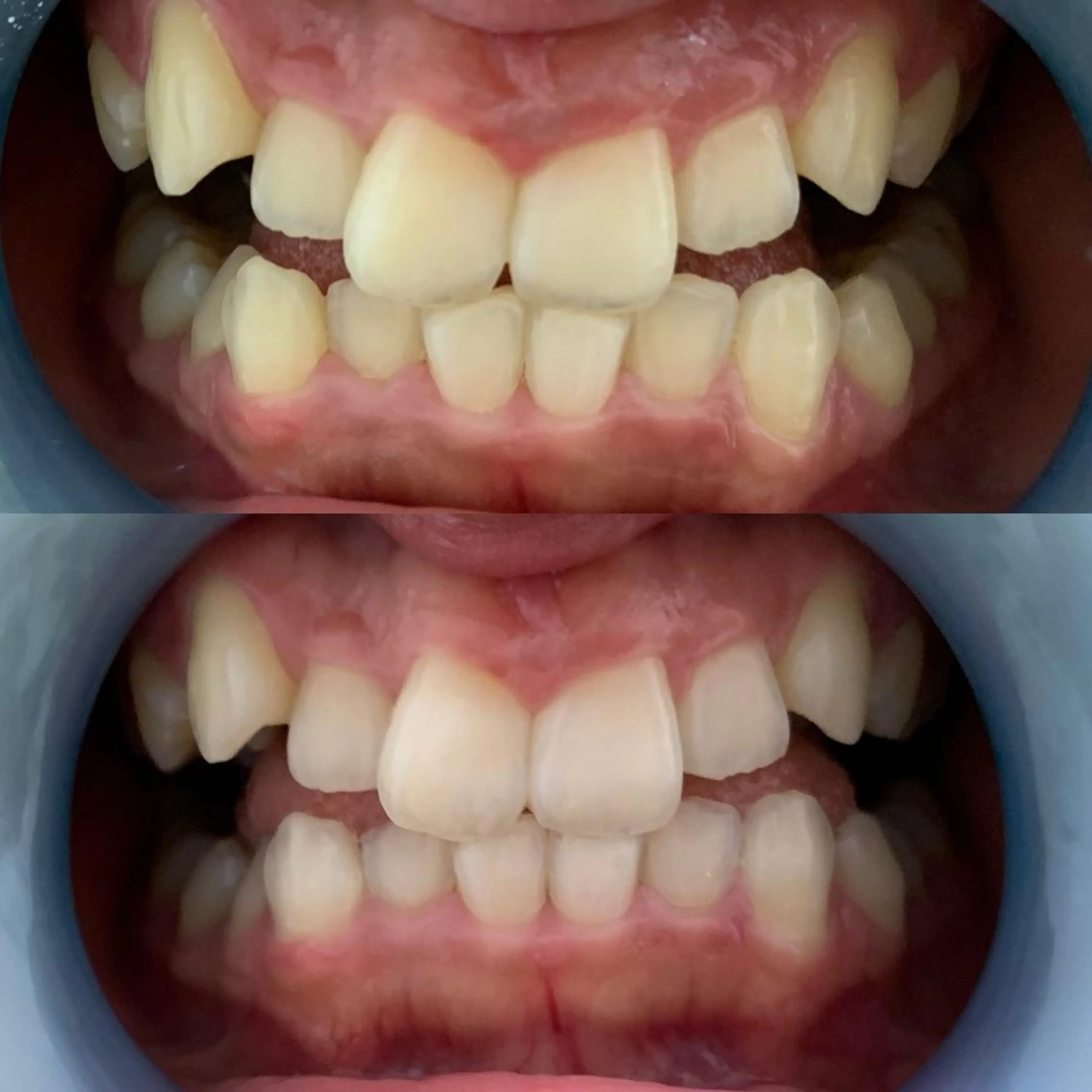 217 ホワイトニングルームのエステ・リラクイメージ