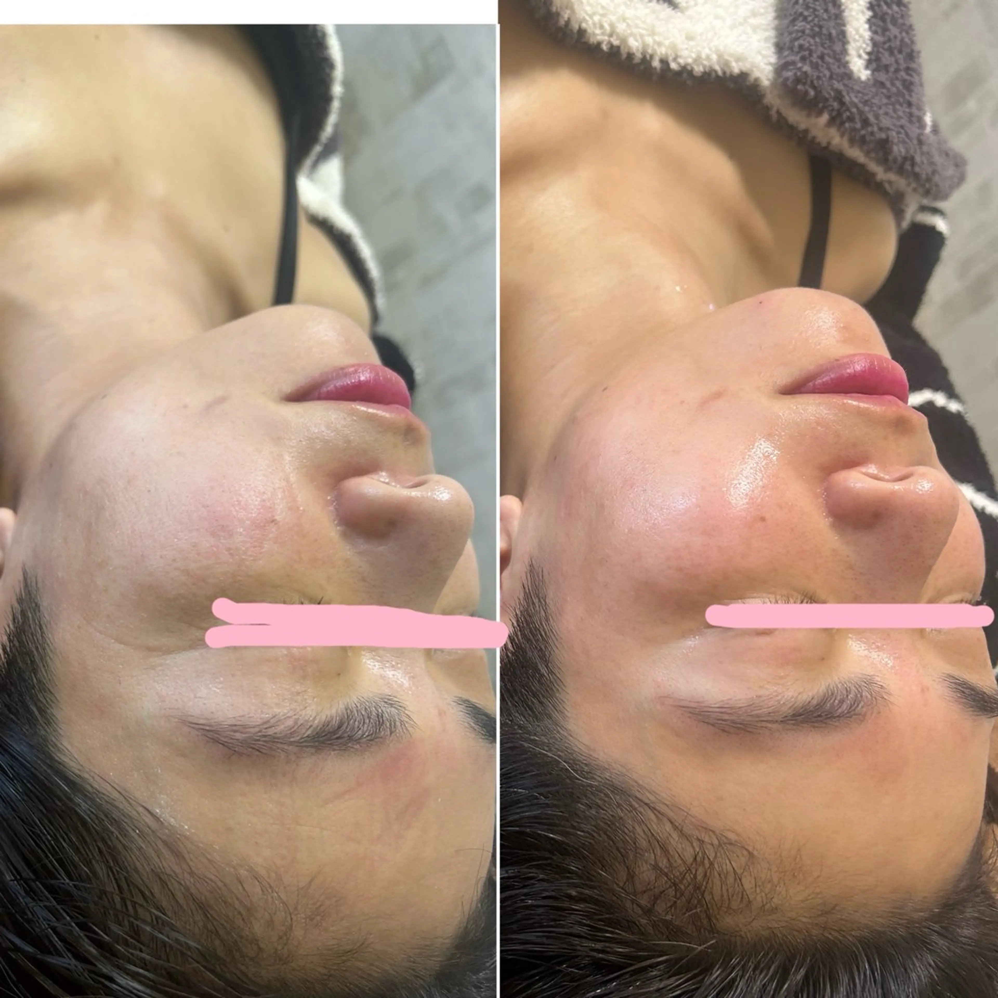 美容鍼灸サロン mahoroba院長のエステ・リラクイメージ