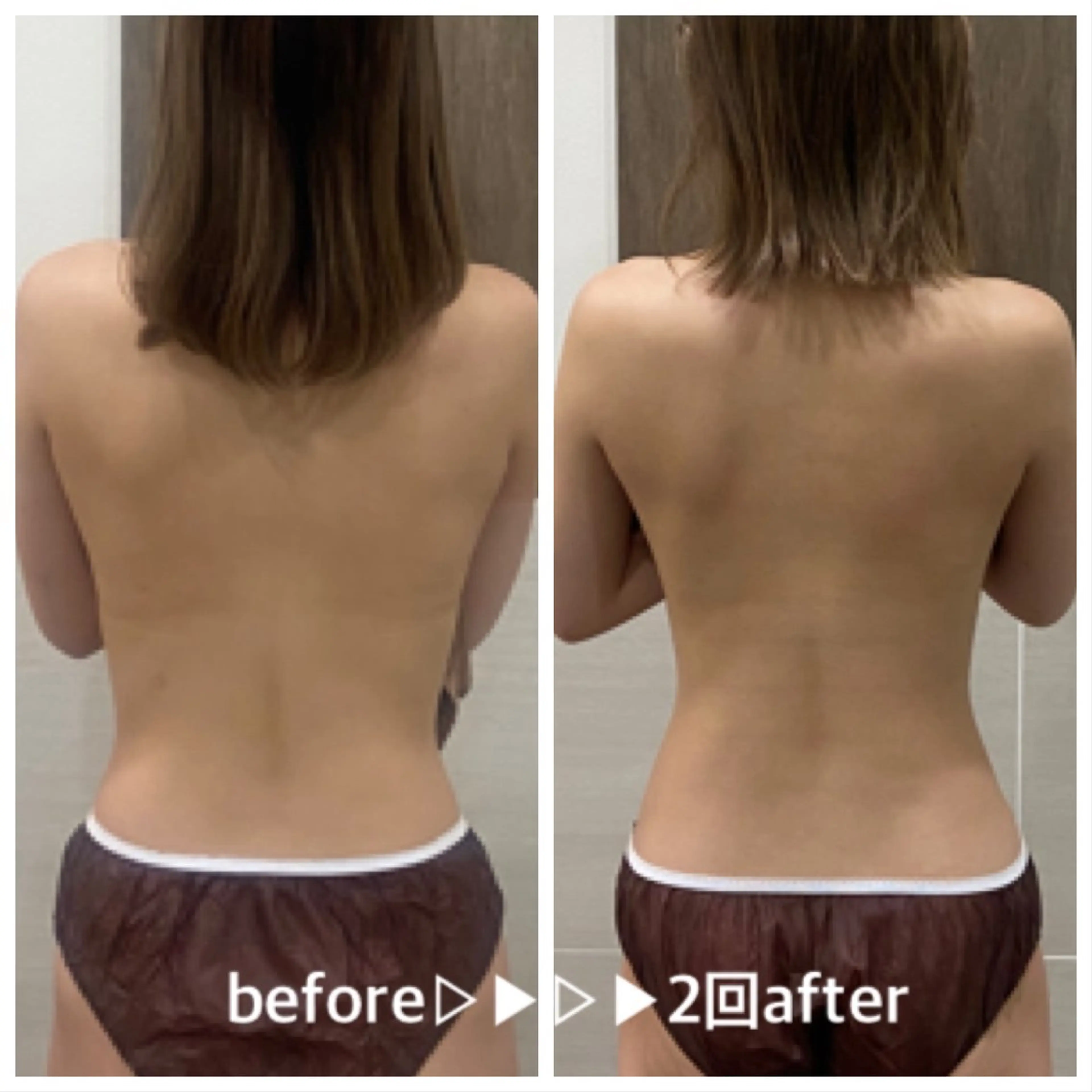 salon ace所属・【小顔矯正】 salonaceのエステ・リラクイメージ