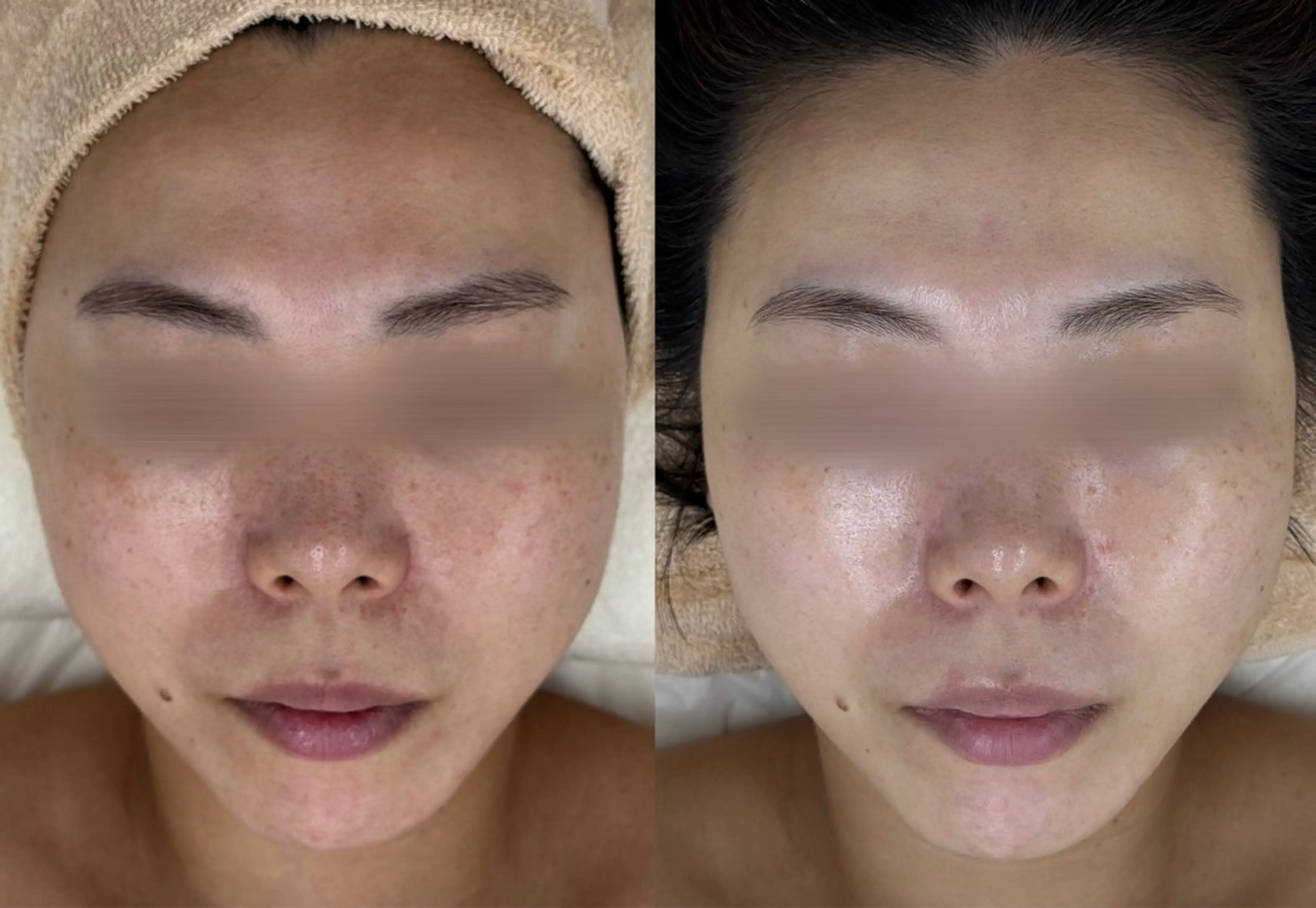 エステ MAILE-マイレ- NARUMIのエステ・リラクイメージ