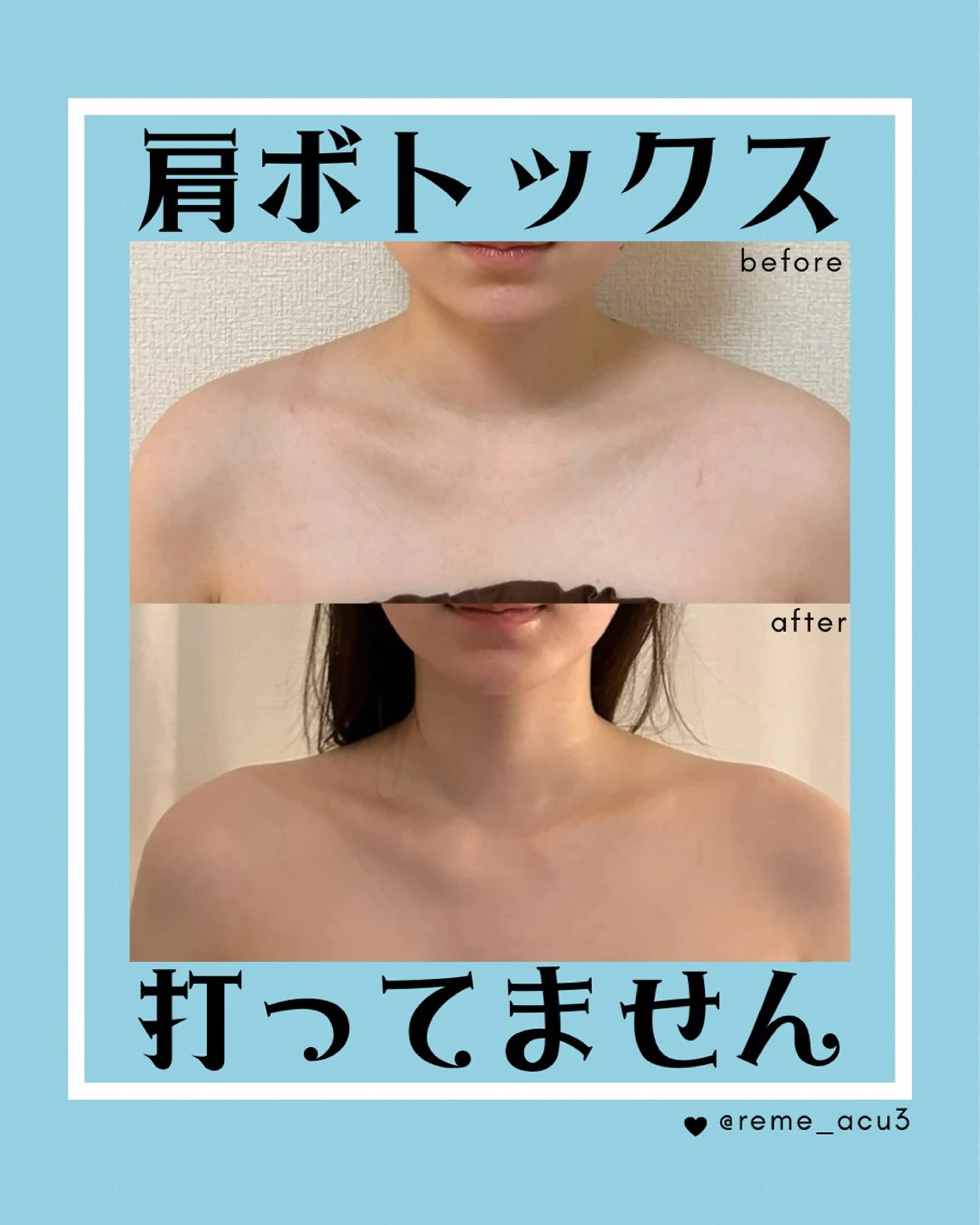 その他 美容鍼WINBACK サロンRemeのエステ・リラクイメージ