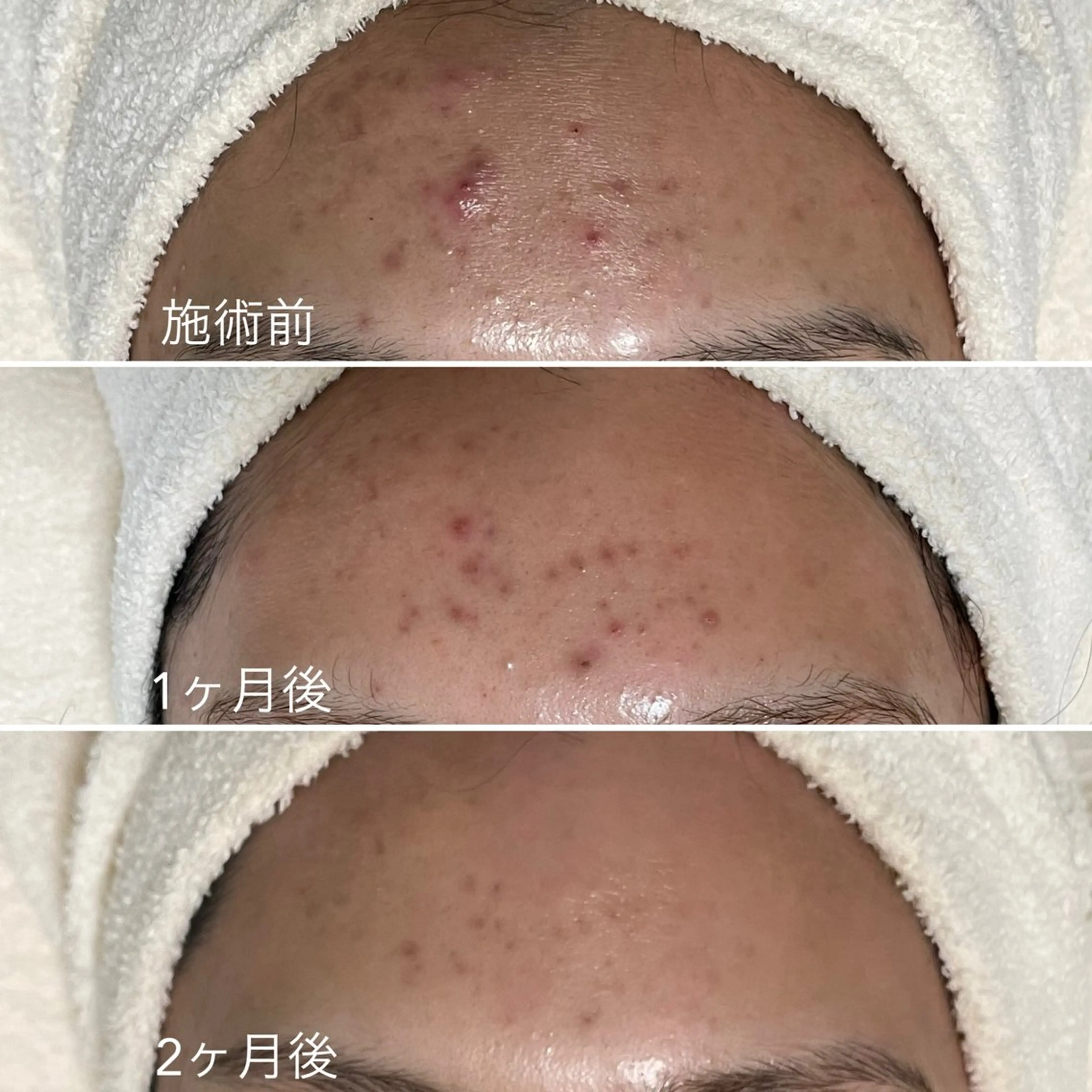 ニキビ・毛穴・ フェイシャル専門店のエステ・リラクイメージ