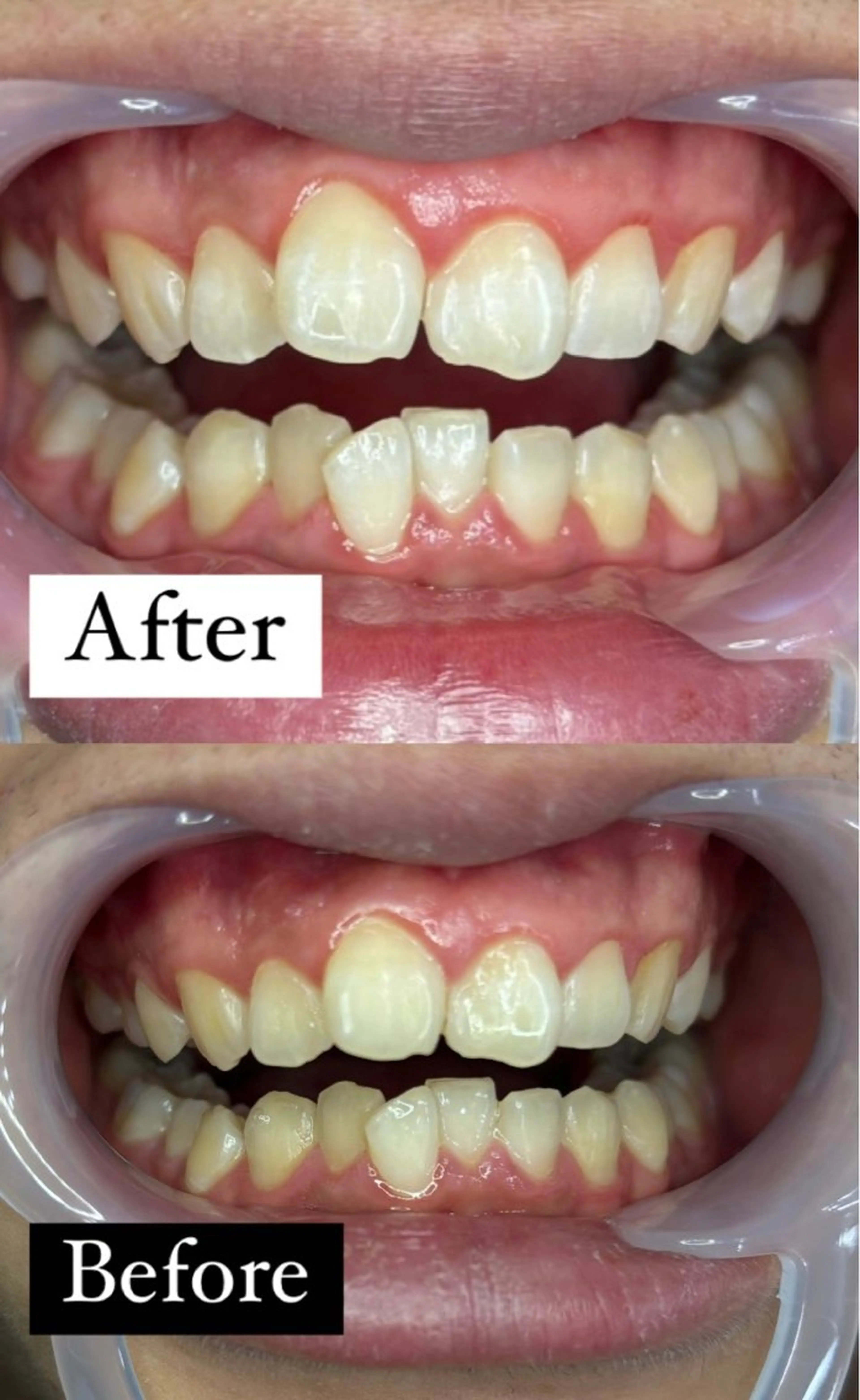 その他 Yuna ⟡.·*.のネイルデザイン