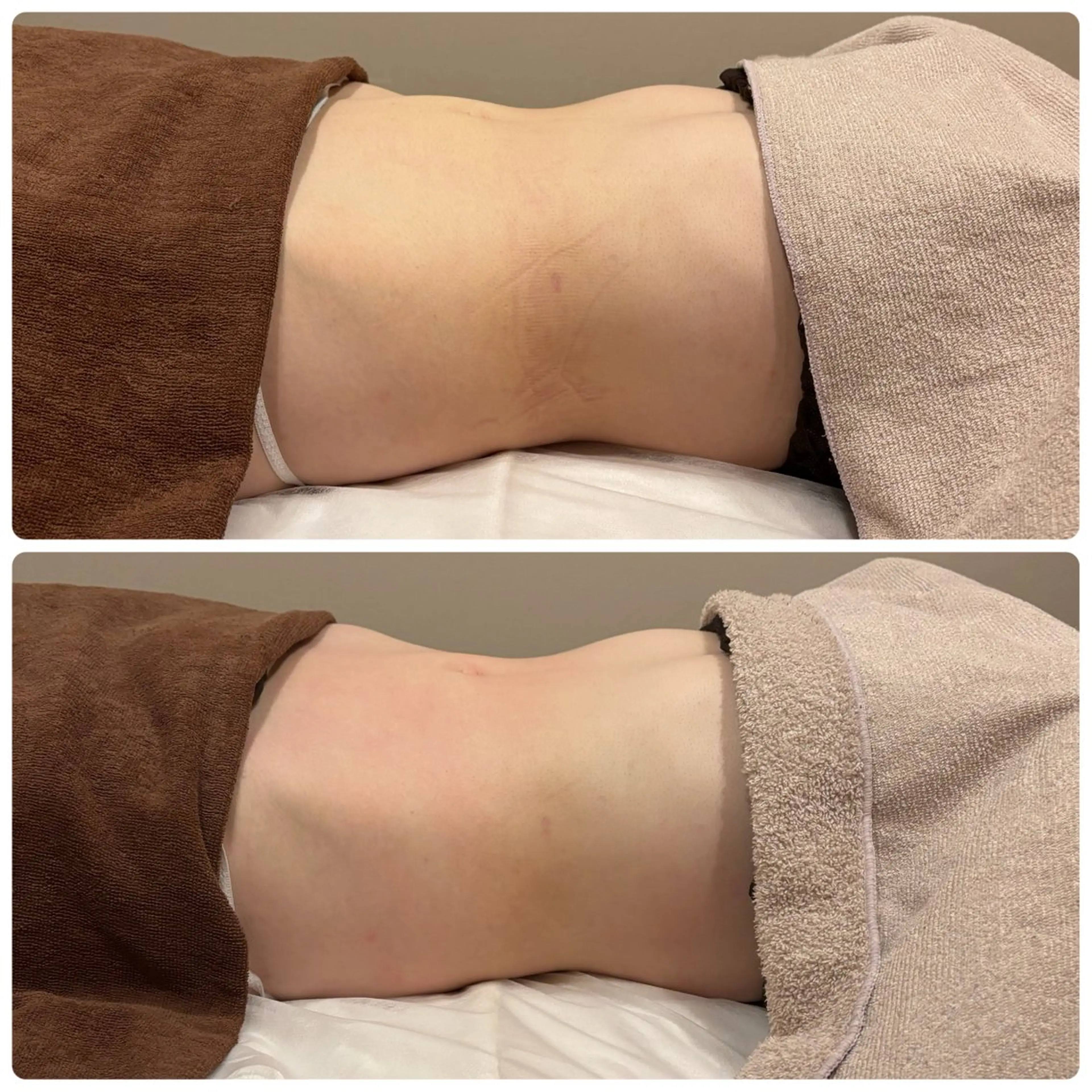 エステ 美肌脱毛サロン muroのエステ・リラクイメージ