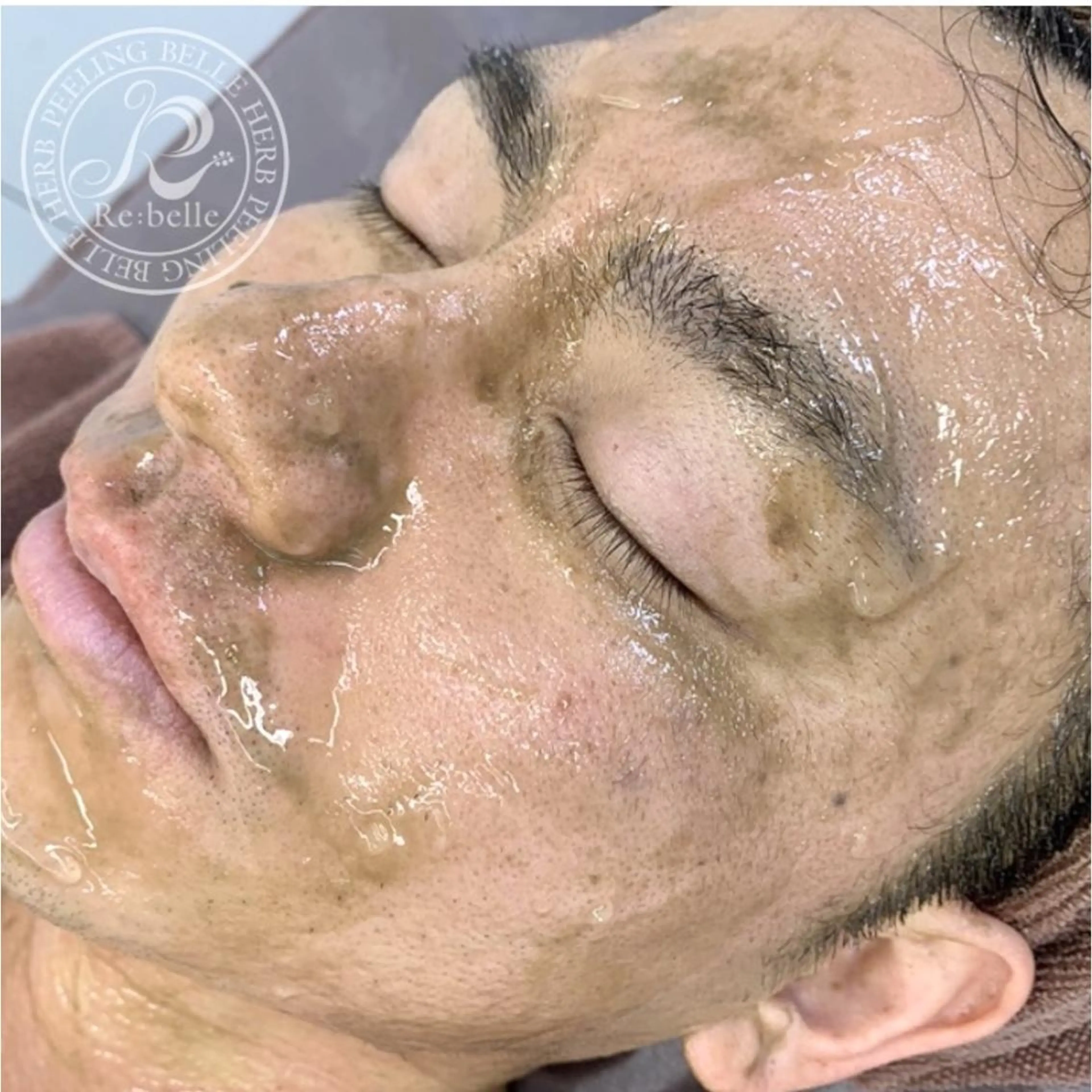 エステ Belsia千歳烏山 ピーリング＆眉毛のエステ・リラクイメージ