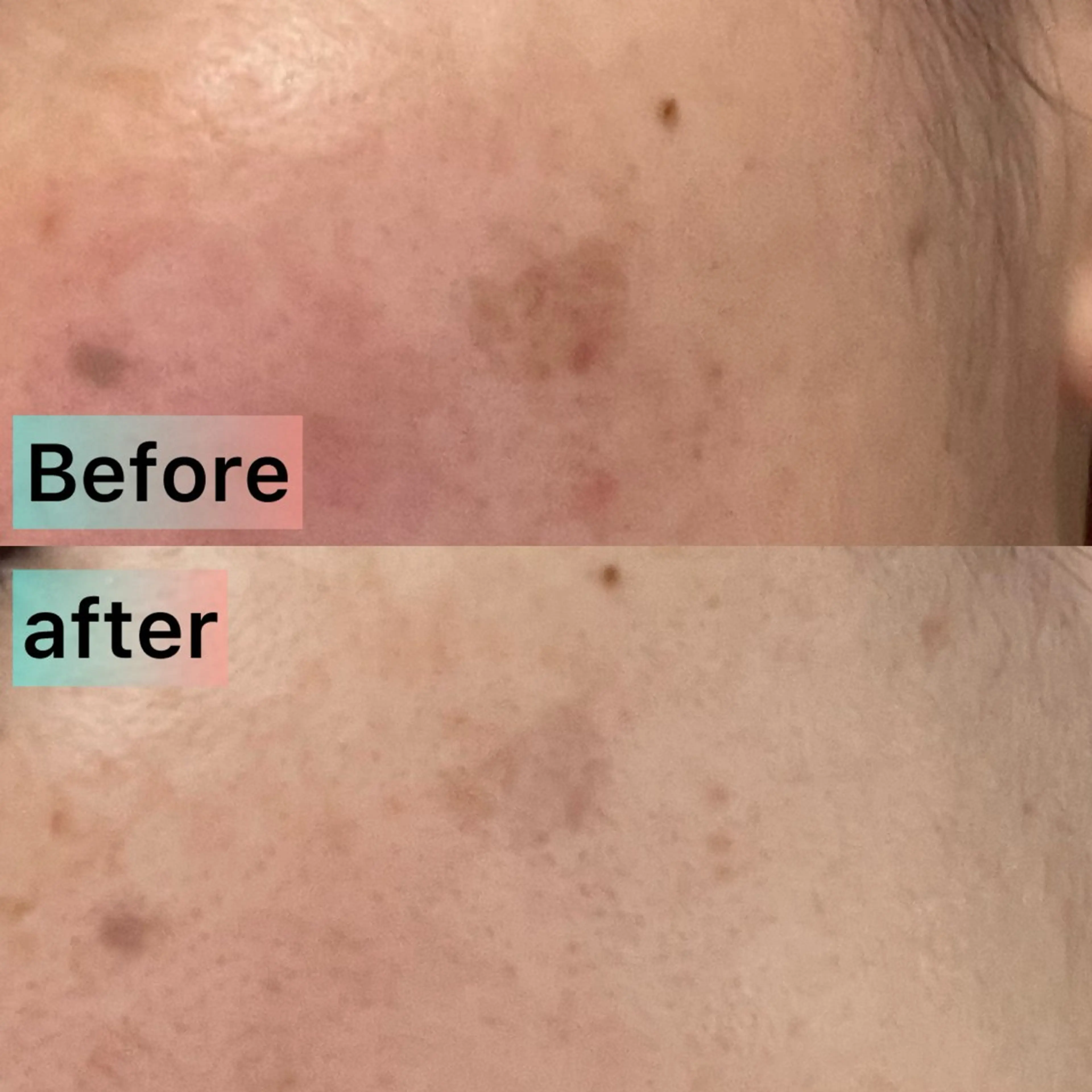 エステ LaBeIIevie ラベルヴィのマツエク・マツパデザイン