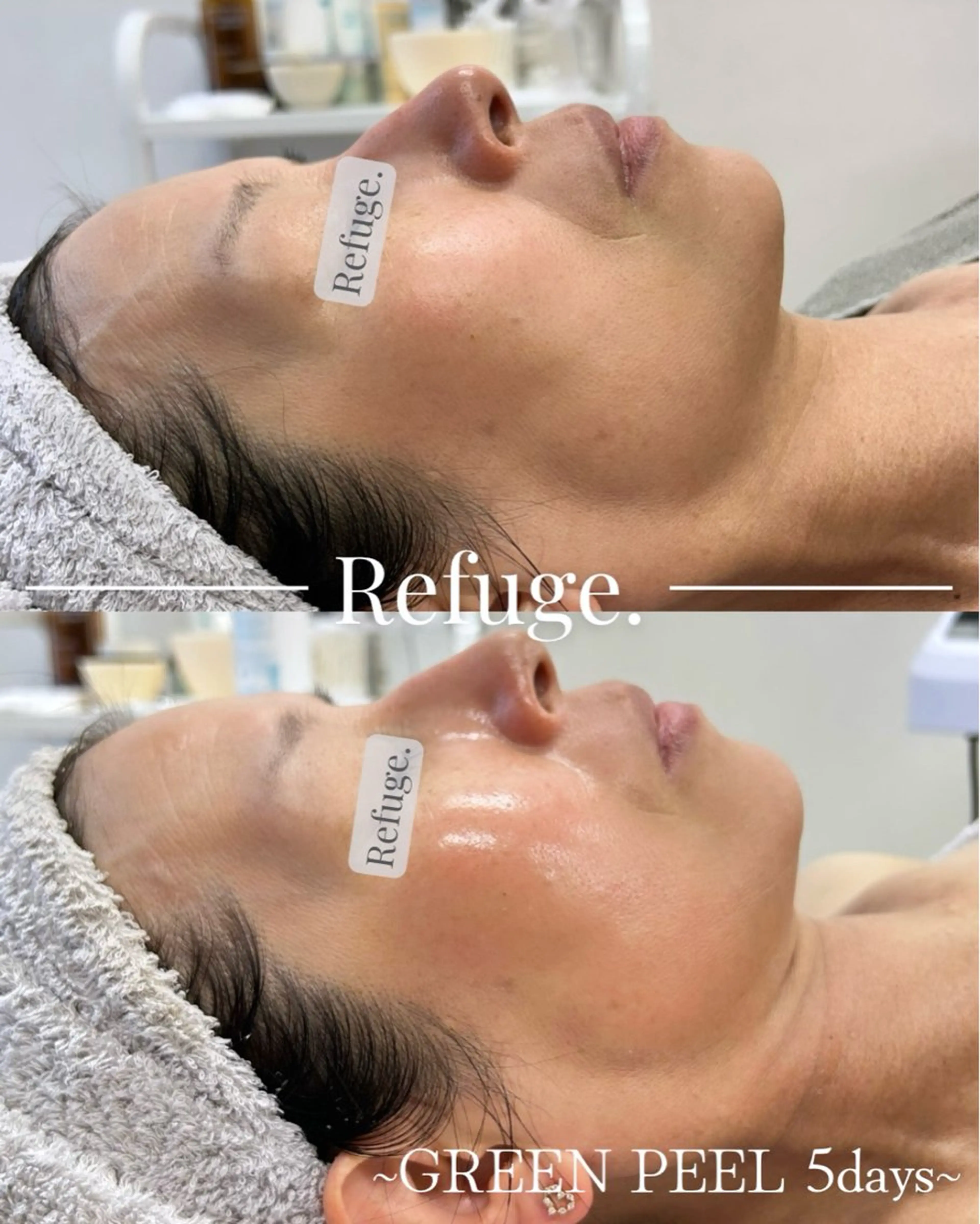 グリーンピール専門サロン Refuge.所属・Refuge. （リフュージュ）のエステ・リラクイメージ