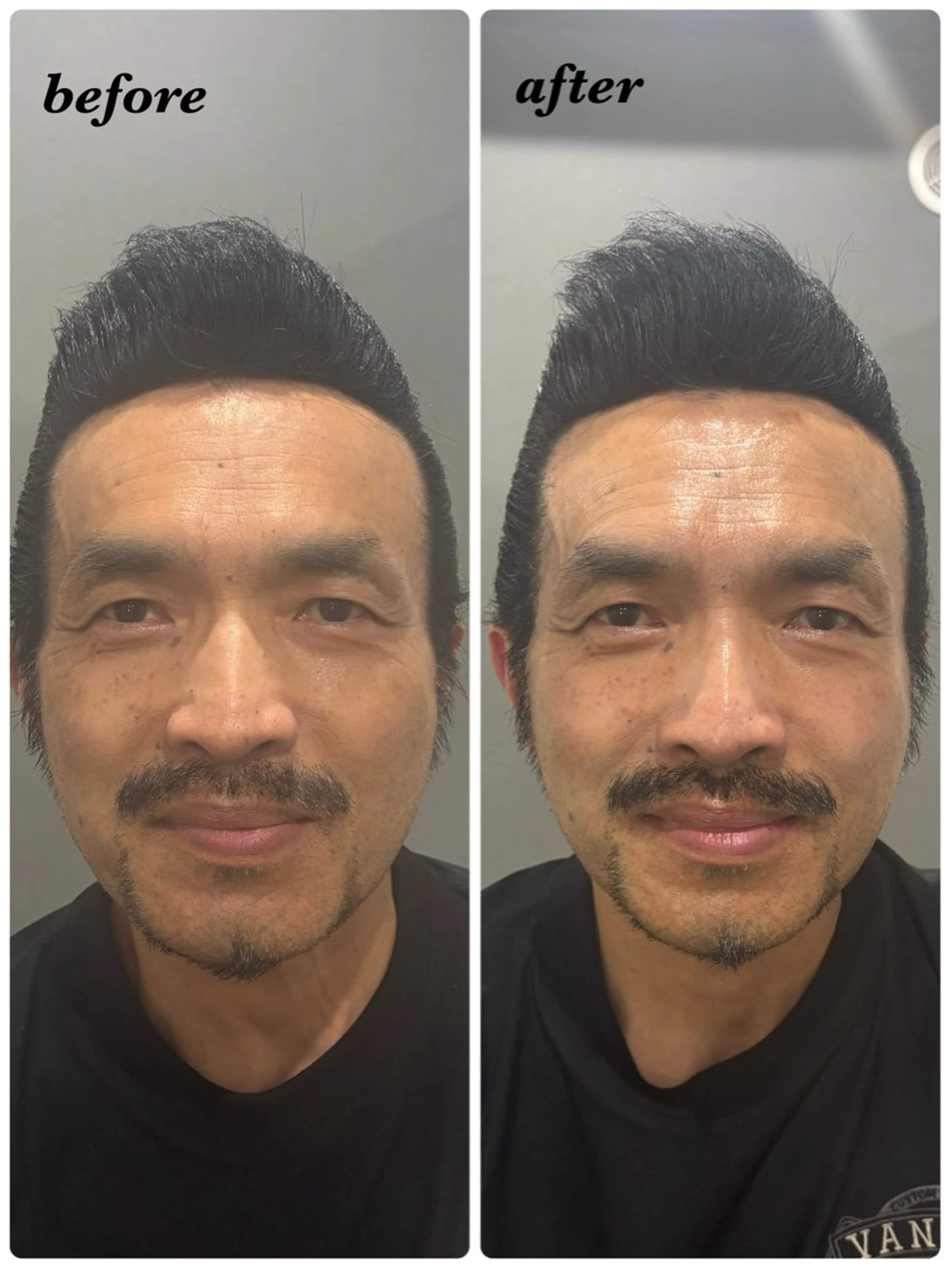 ハーブピーリング専門 毛穴洗浄❤️眉waxのエステ・リラクイメージ