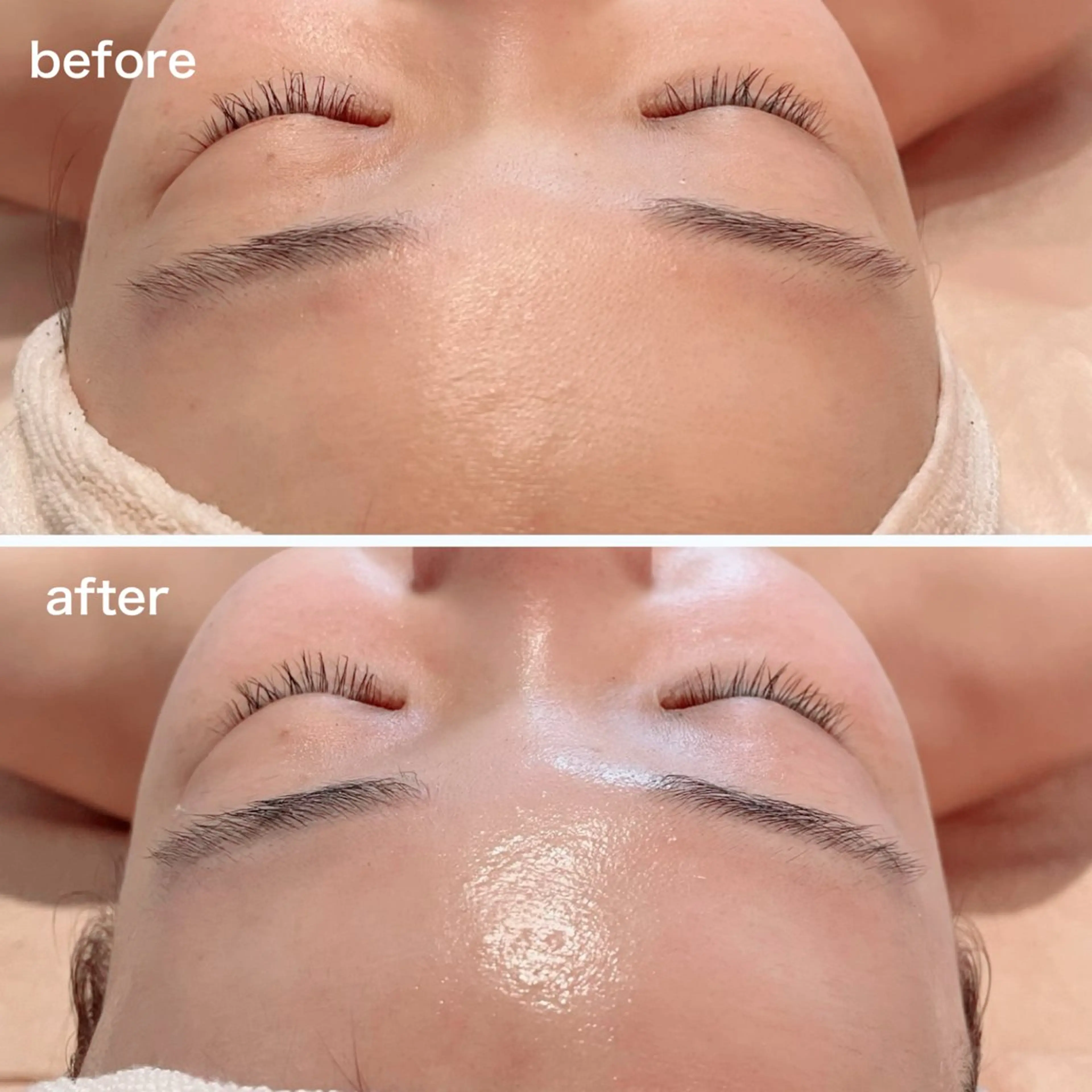 mignon /まつげパーマ・小顔のエステ・リラクイメージ