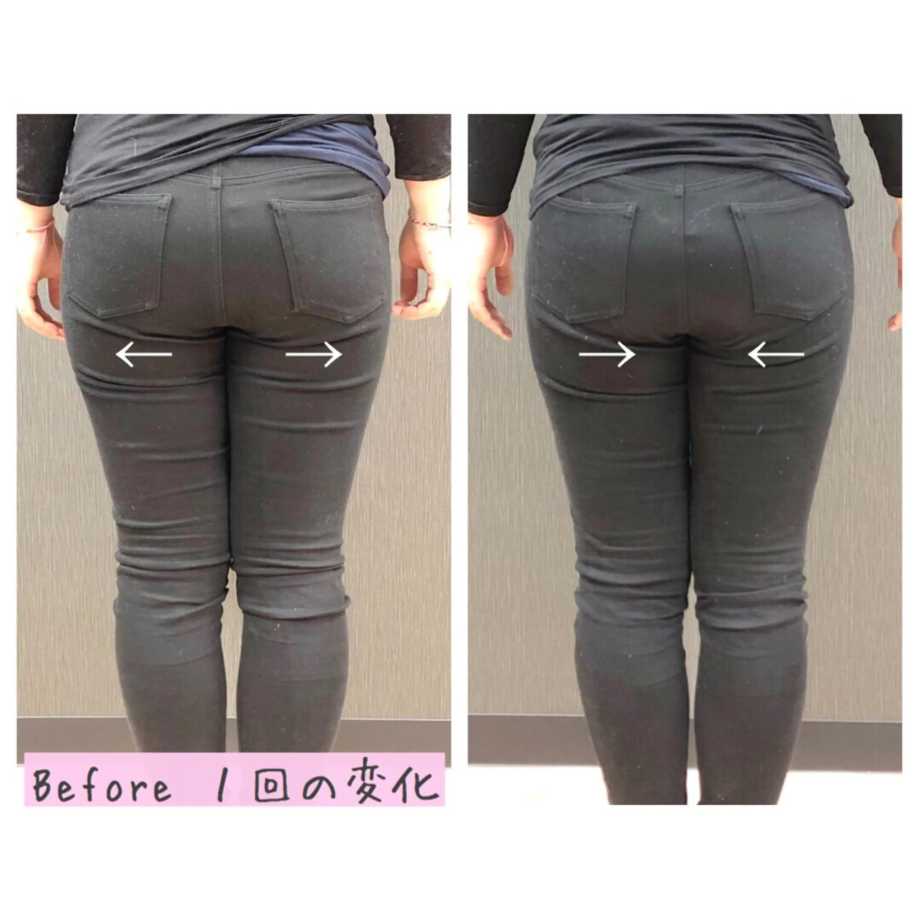 小顔モニター 募集のエステ・リラクイメージ