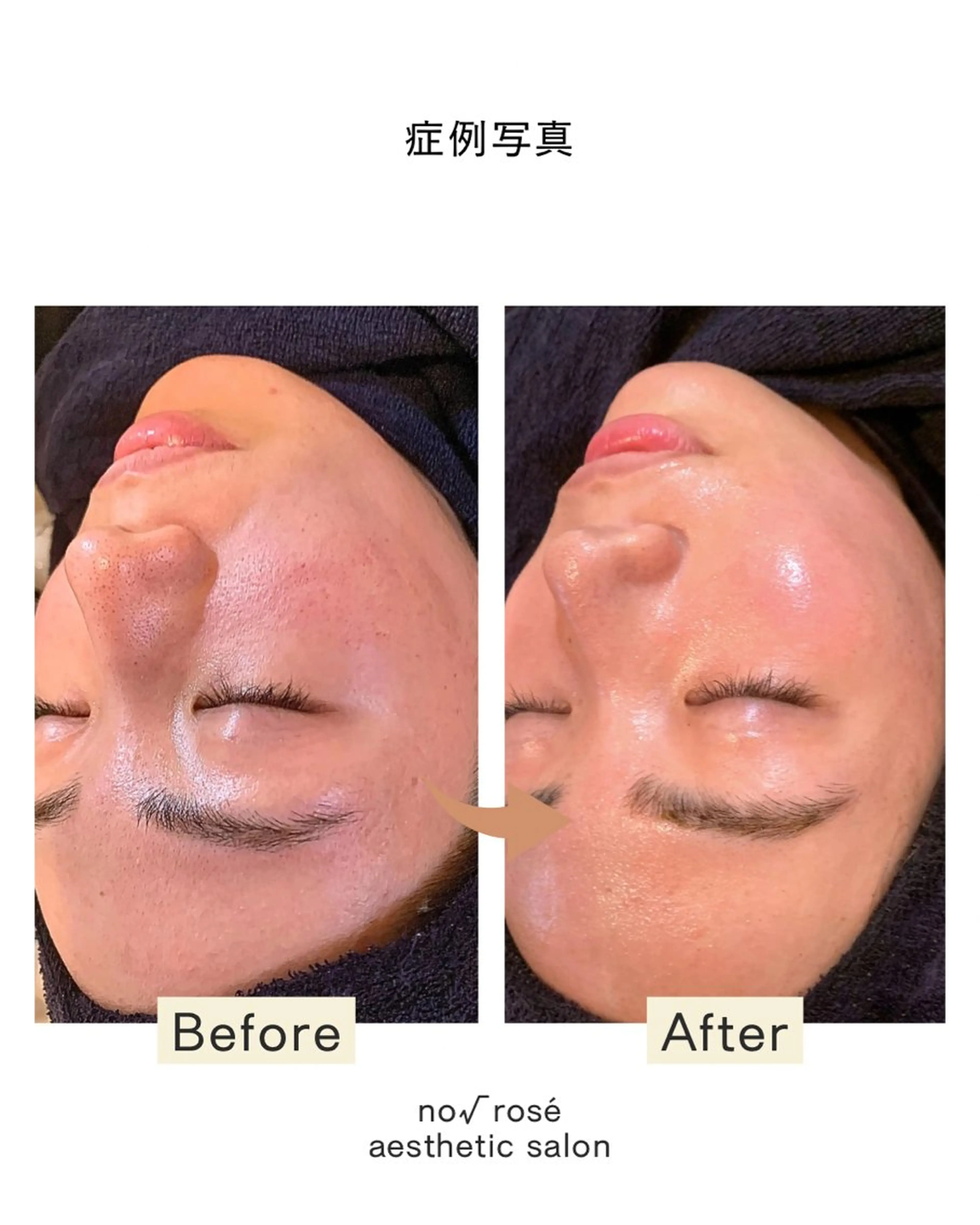 エステ ノールート ロゼのエステ・リラクイメージ