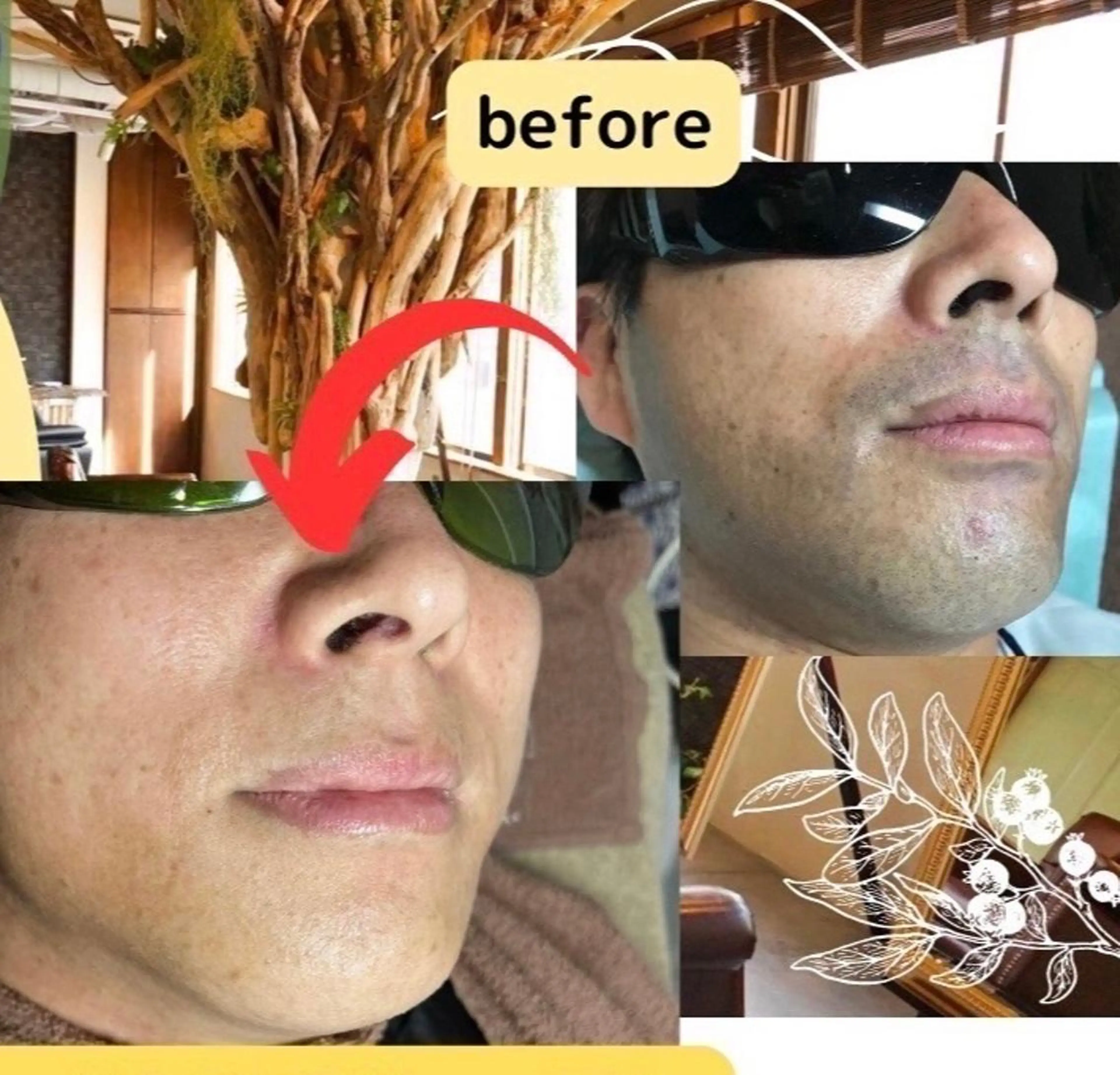 メンズ両脇脱毛の写真