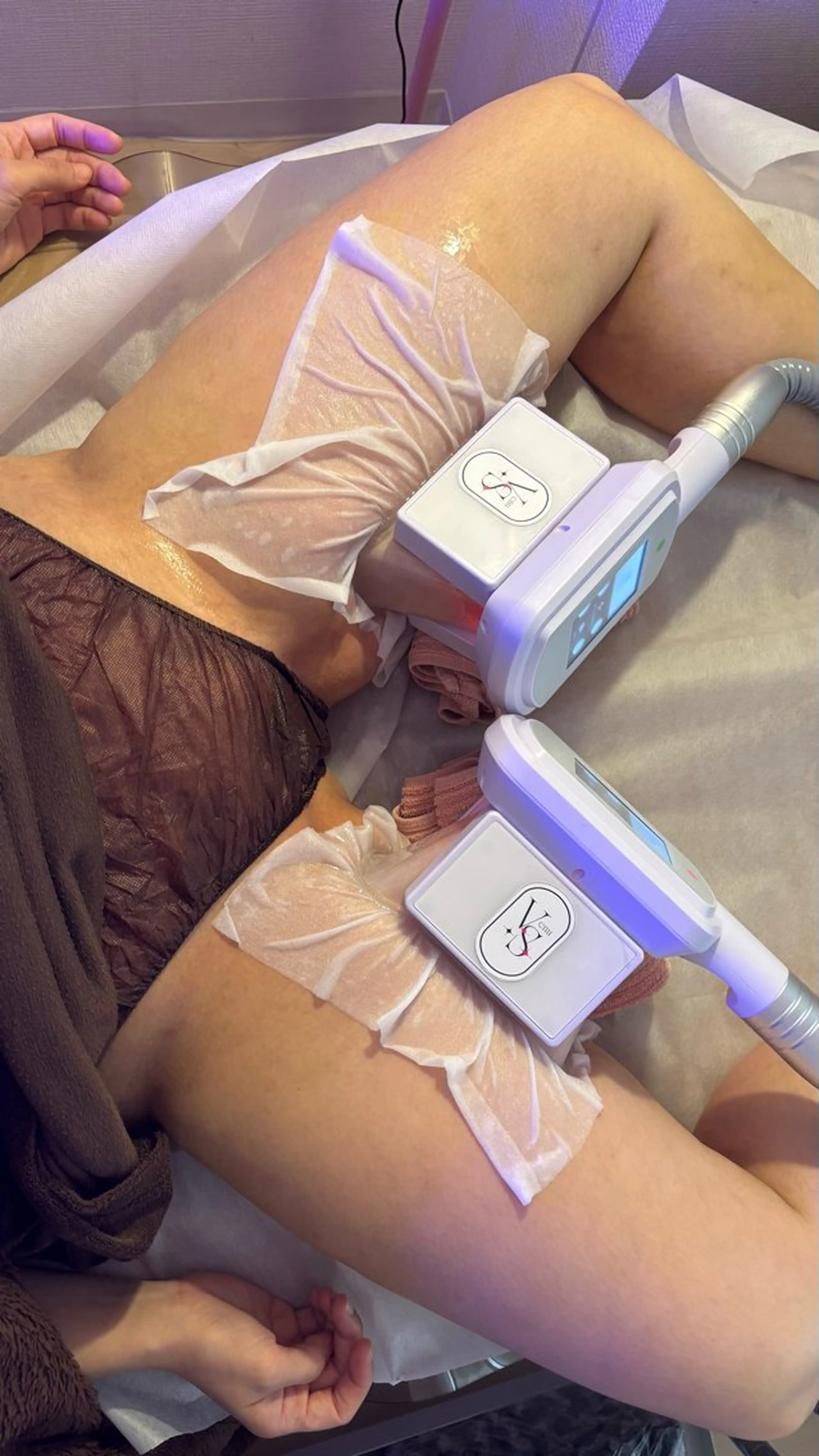 脂肪排泄！−4℃​〜​12℃で　脂肪を凍らせて捨てる？！1カップ4900円2カップ8300円！の写真