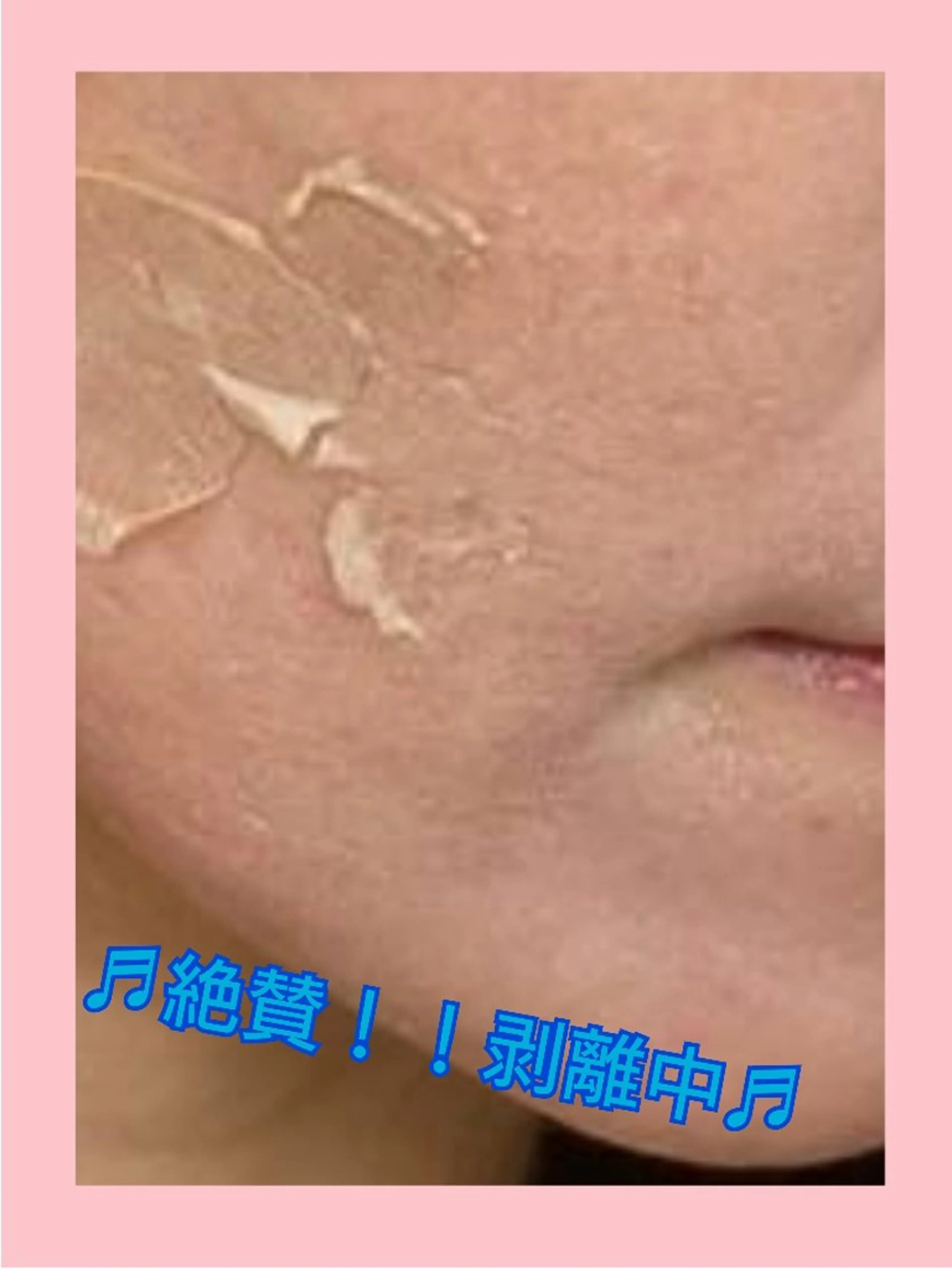 エステ ハーブピーリング 専門店Kikkaのエステ・リラクイメージ