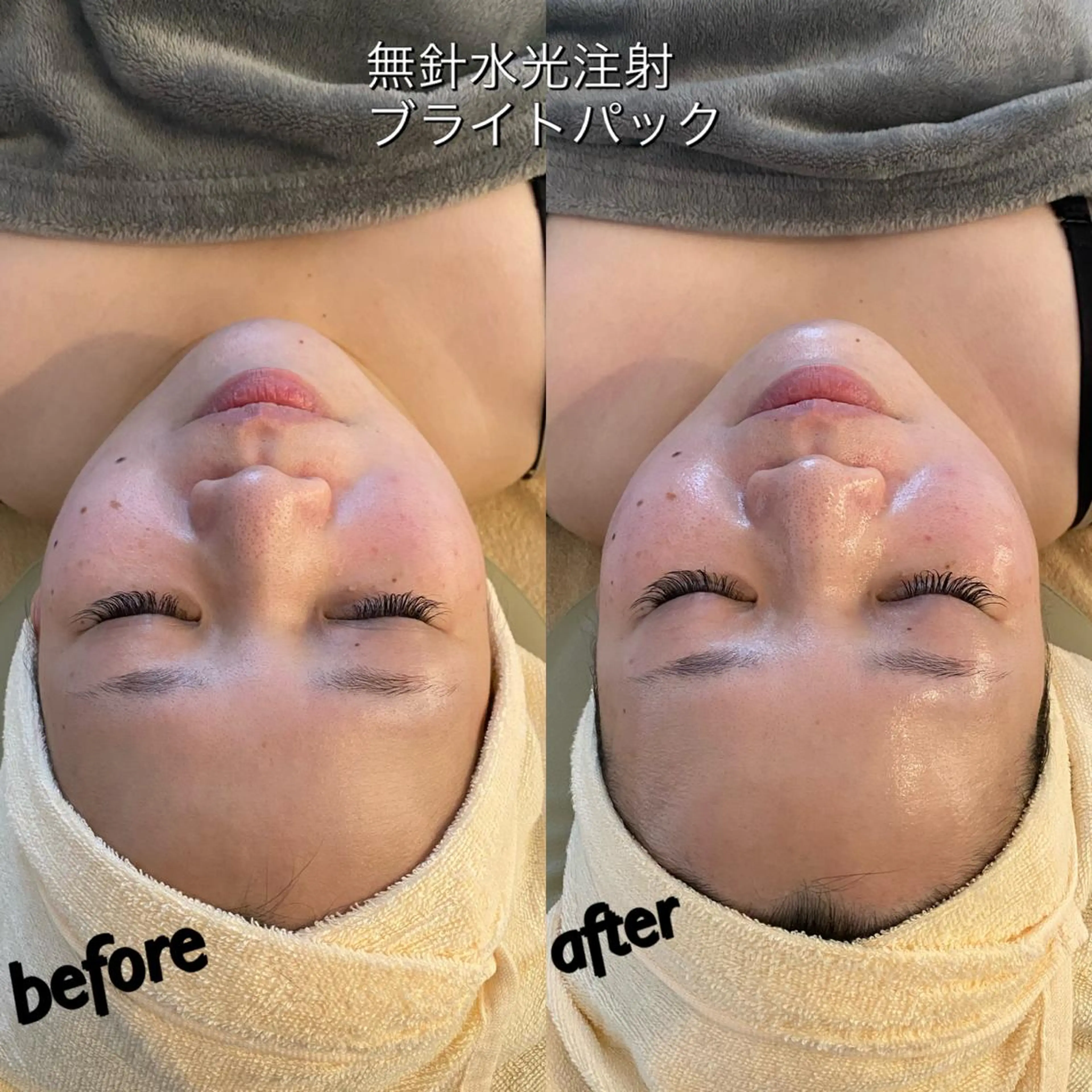 うなじ脱毛/美肌脱毛 LABELのエステ・リラクイメージ