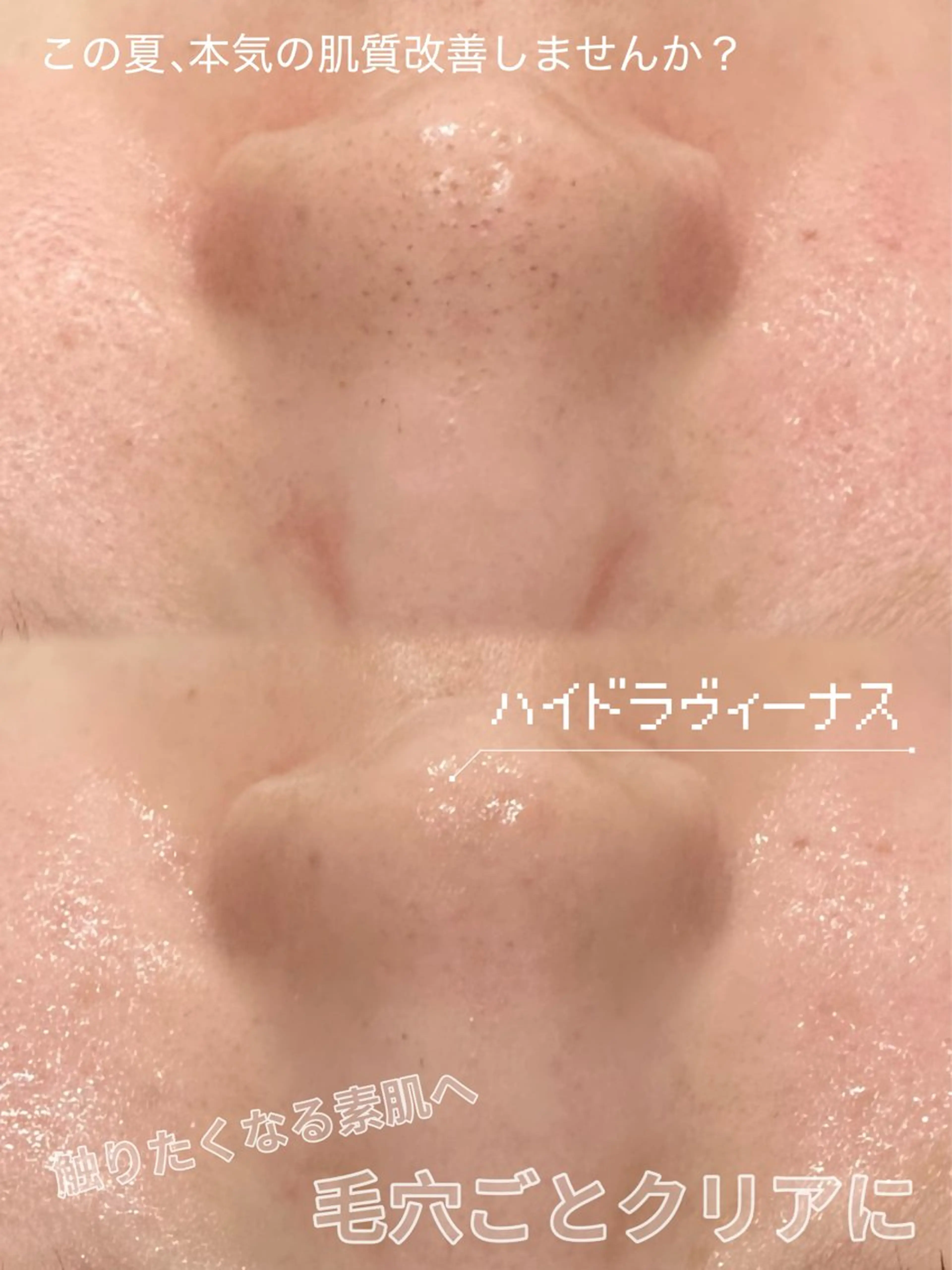 Unknown.姫路 いさと🍓のエステ・リラクイメージ