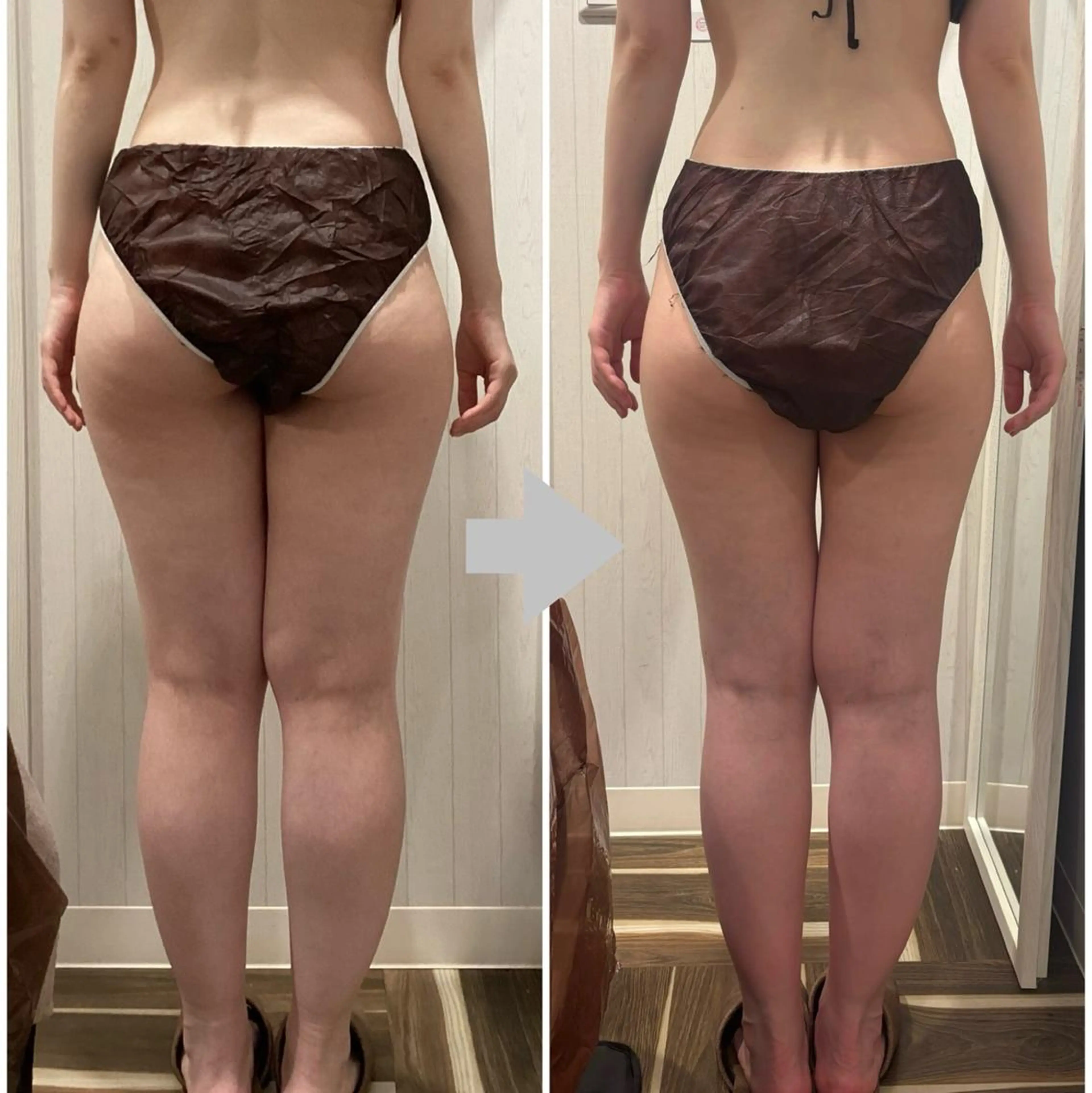 エステ 痩身脱毛専門店 Partirのエステ・リラクイメージ