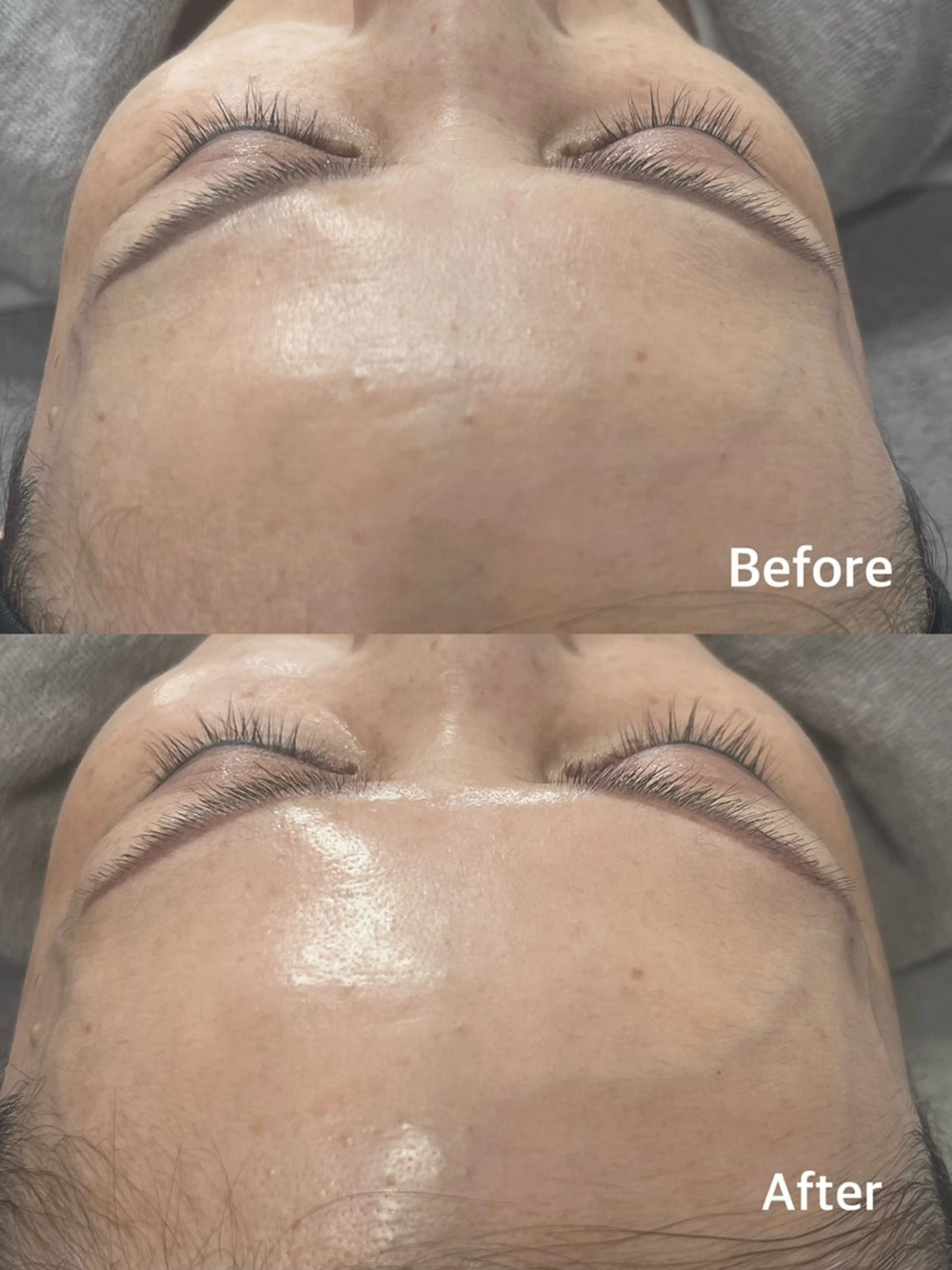 韓国式肌管理 ララピール専門のエステ・リラクイメージ