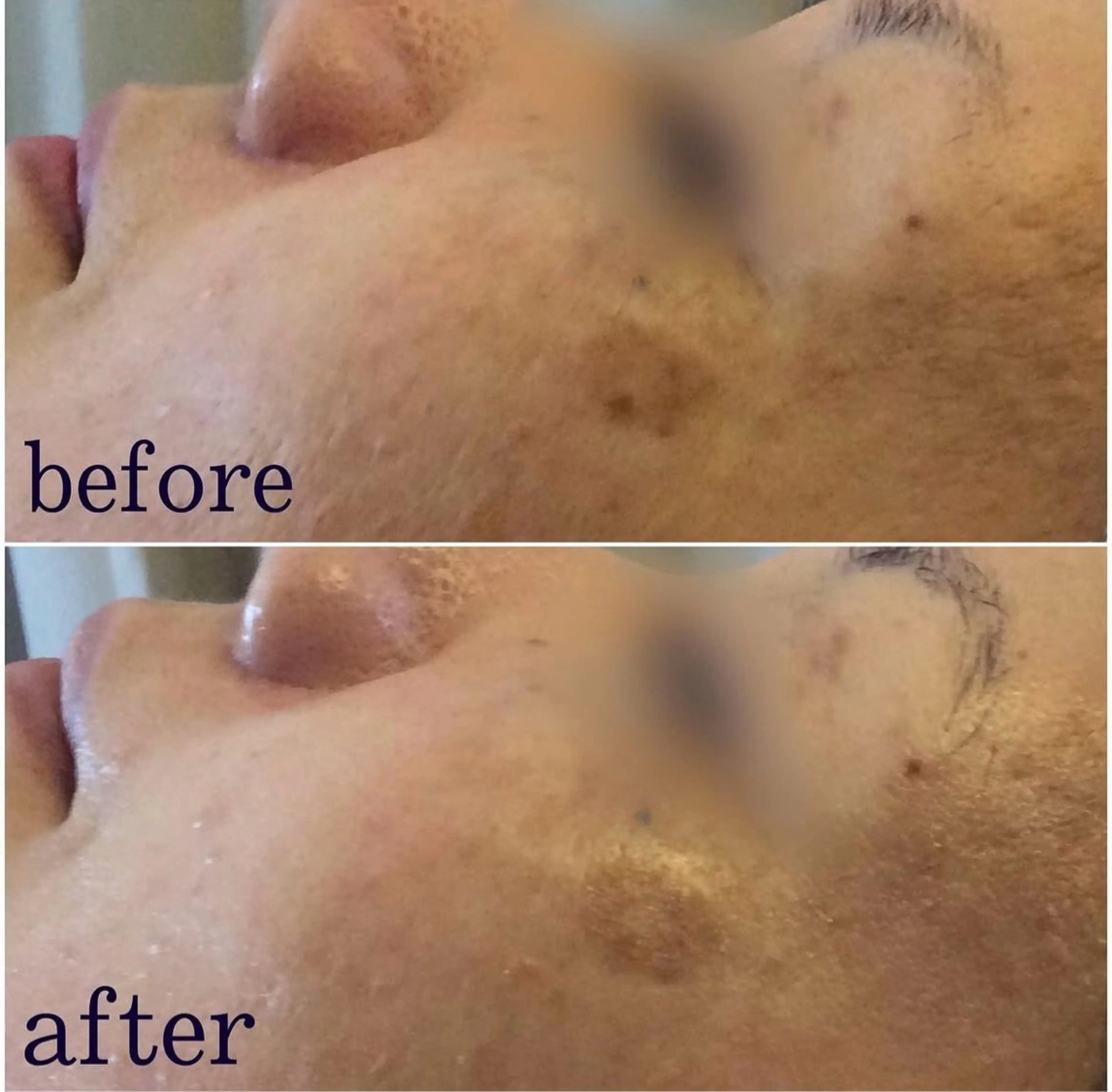 エステ Salon de Bis所属・サロン ド ビス 髙橋美月のエステ・リラクイメージ