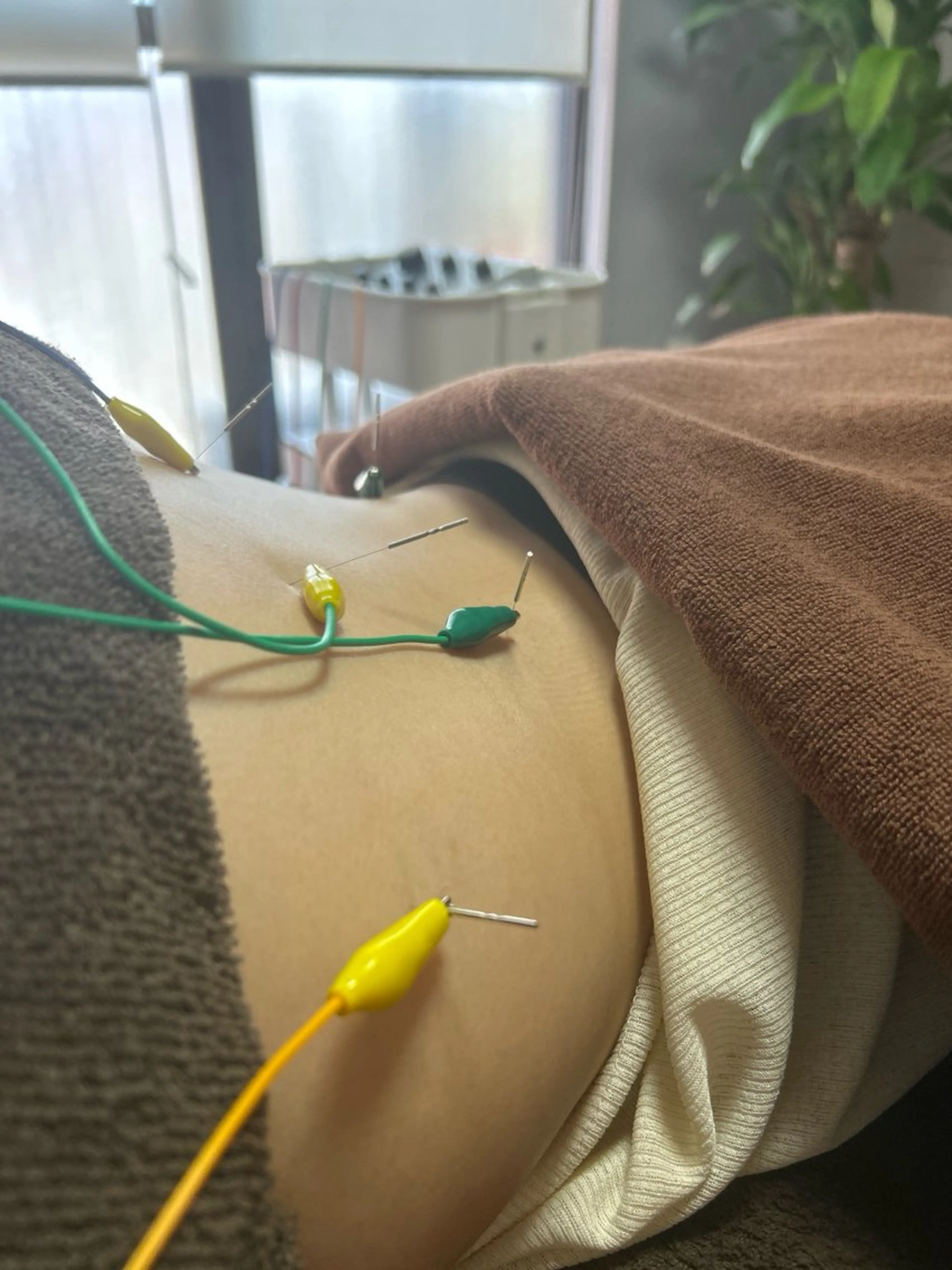 clear鍼灸院 清水【吉祥寺】のエステ・リラクイメージ